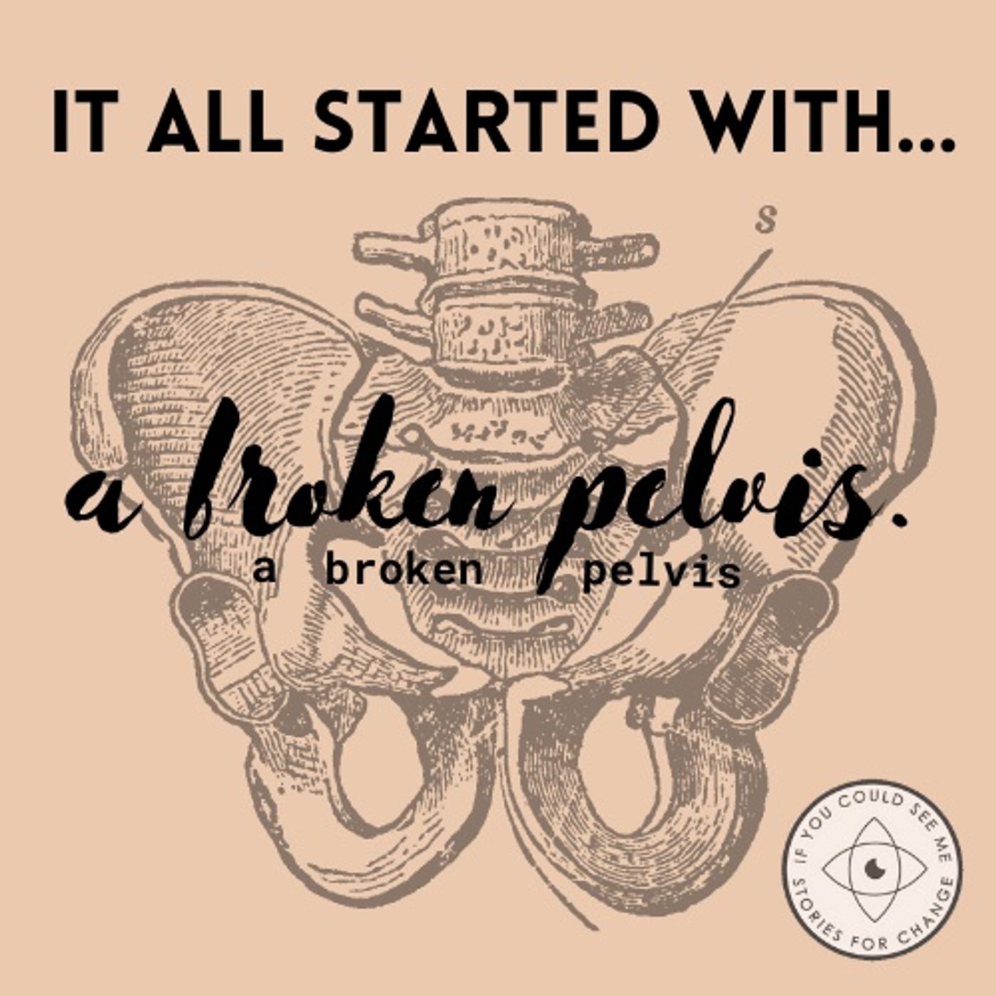 It all Started with a Broken Pelvis:  Episode 1 Rebroadcast