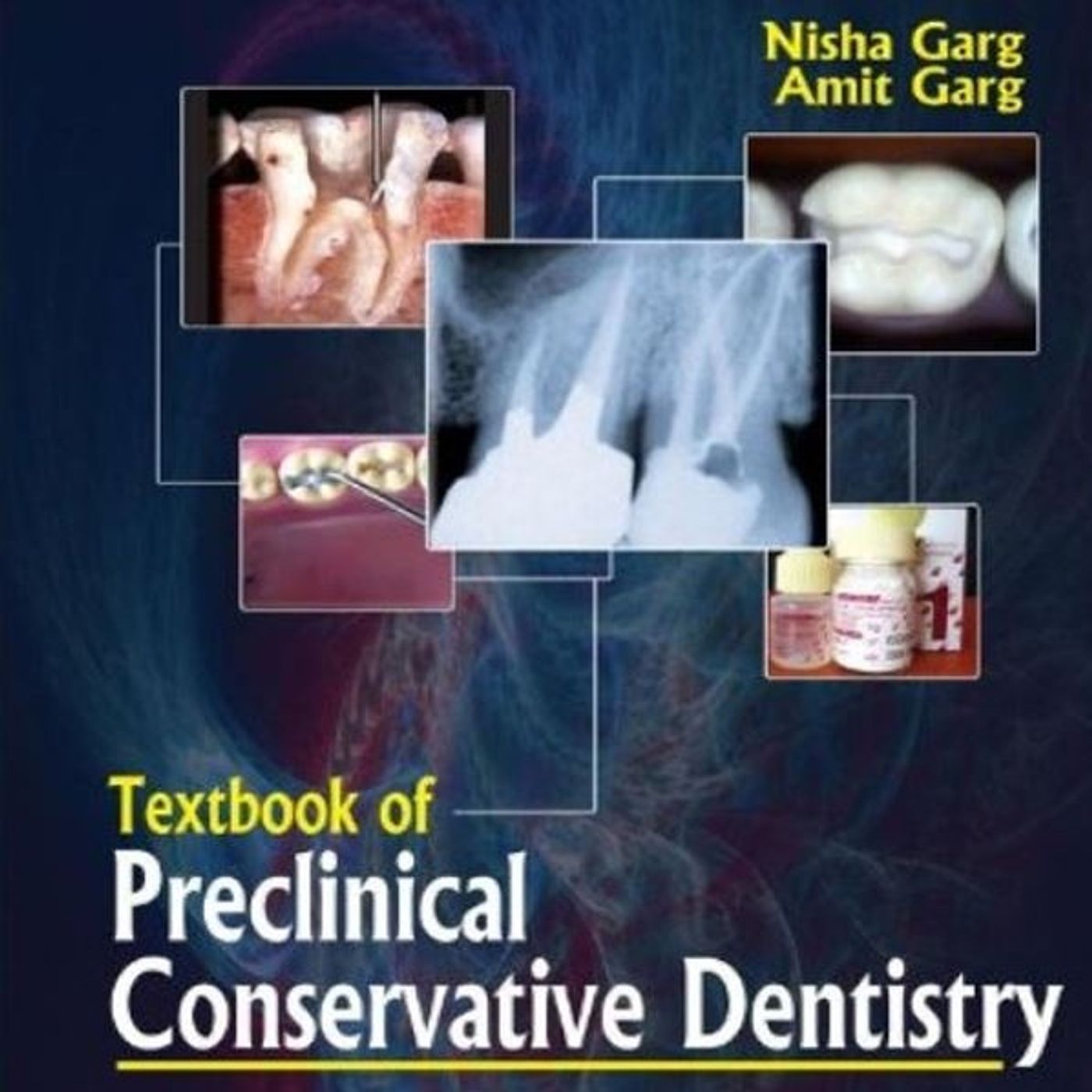 Textbook of Preclinical Conservative Dentistry