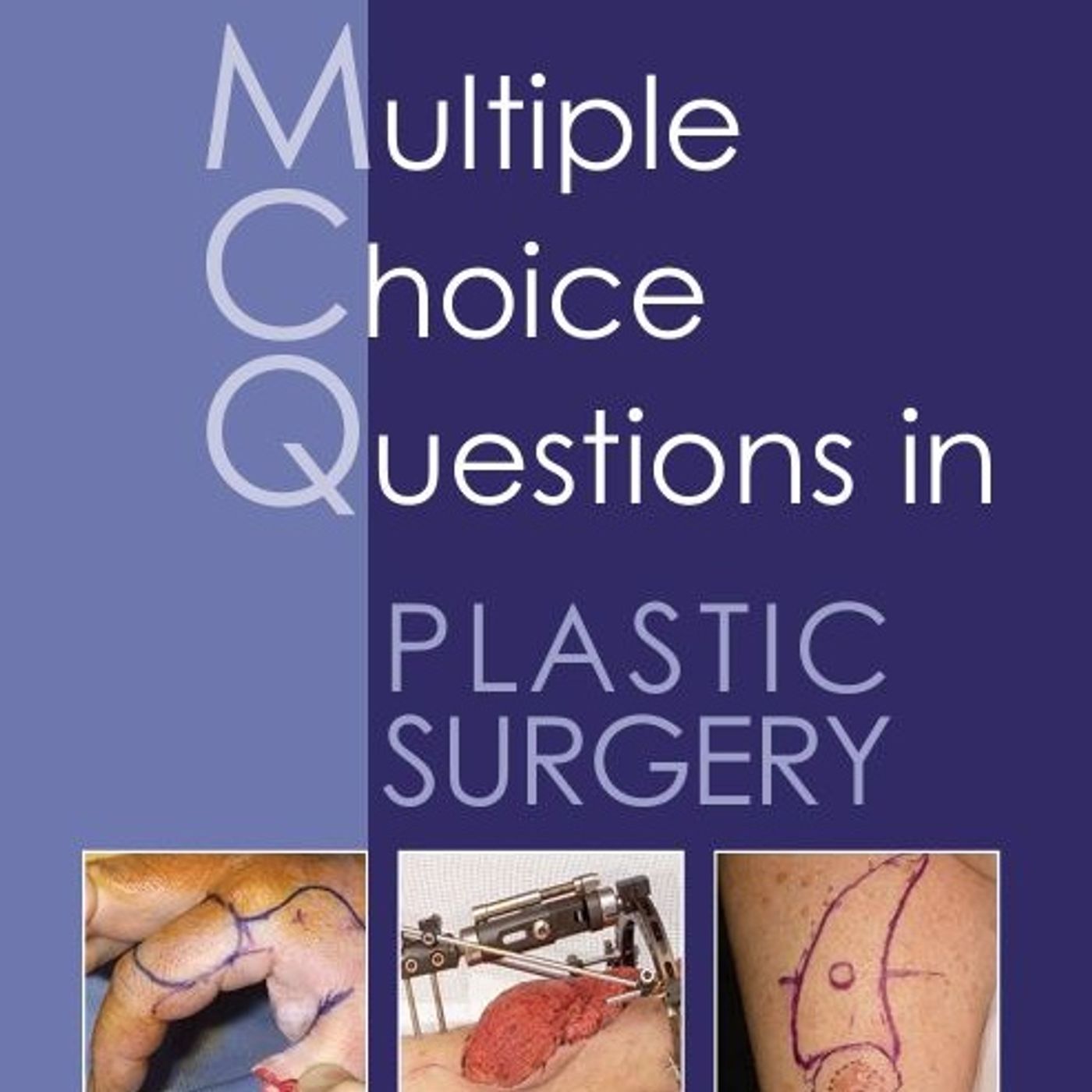 Multiple Choice Questions in Plastic Surgery
