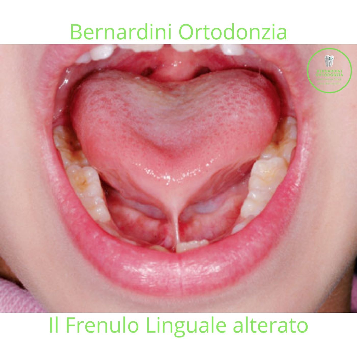 Ortodonzia Bernardini Podcast