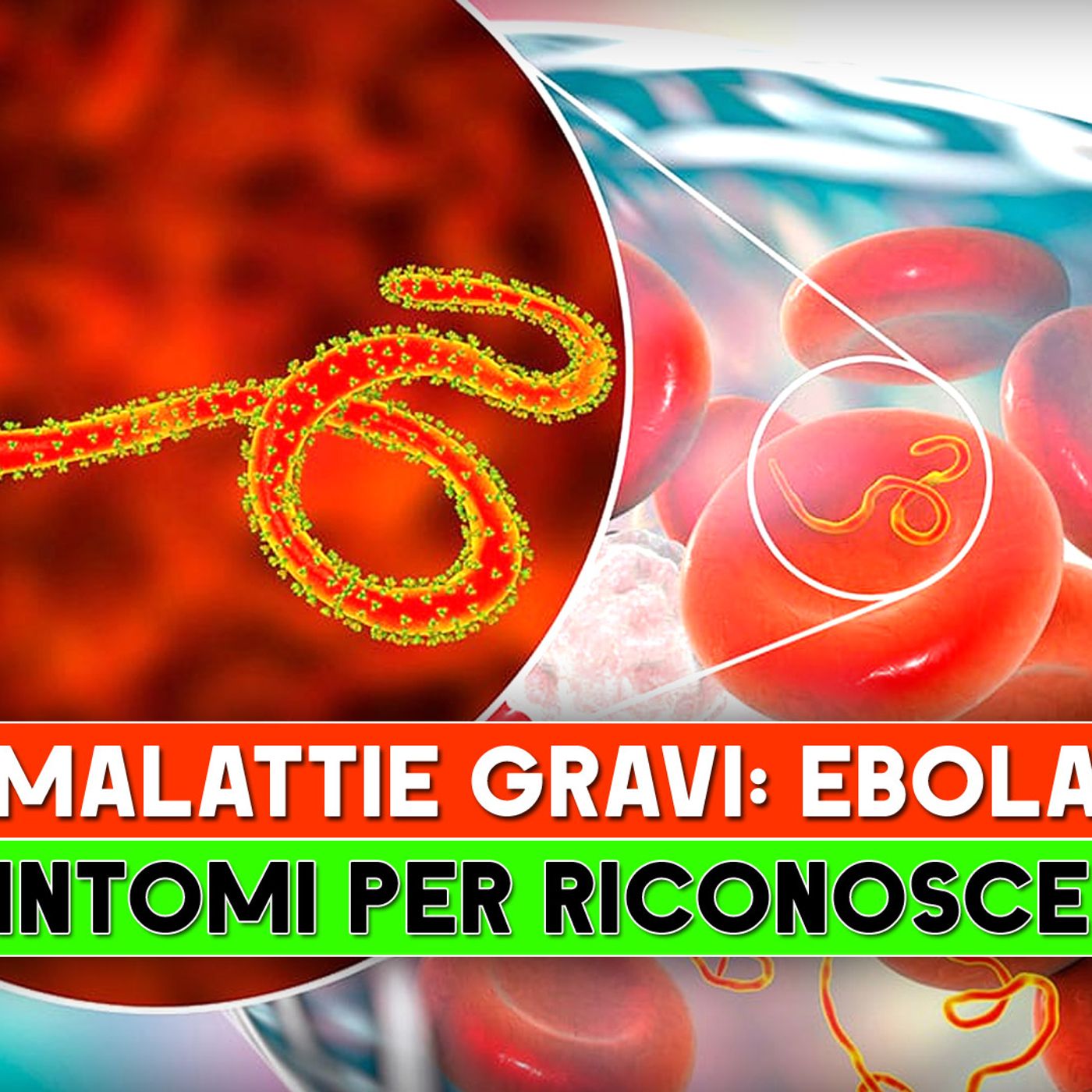 Malattie Gravi, Ebola: I 5 Sintomi Per Riconoscerla! episode artwork
