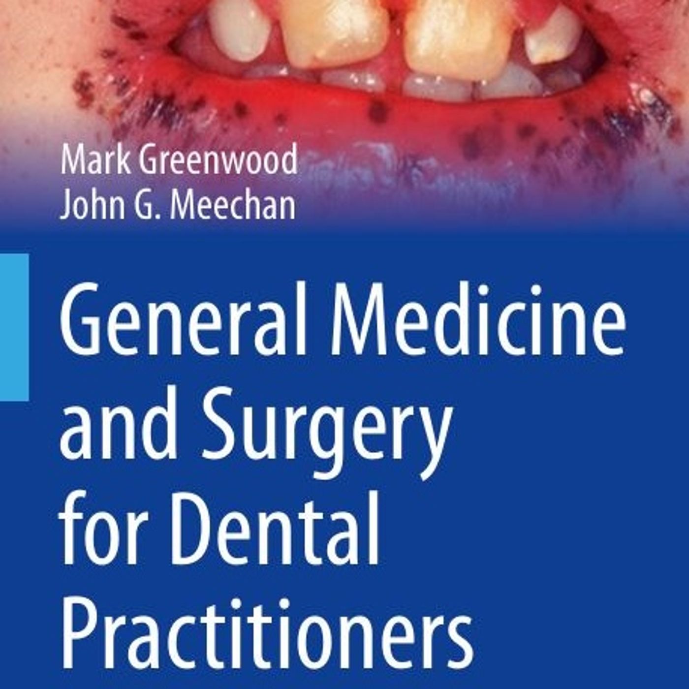 General Medicine and Surgery for Dental Practitioners