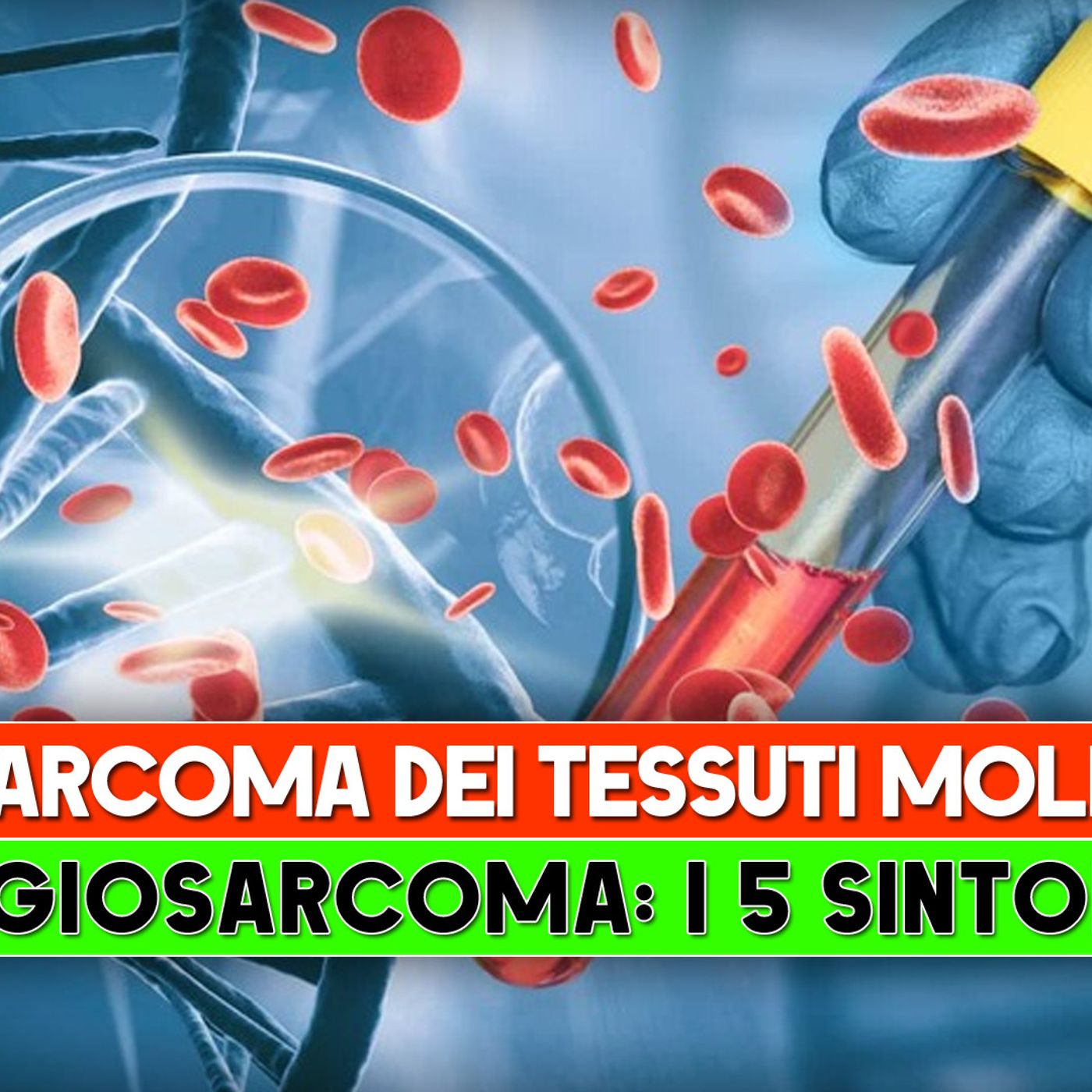 Sarcoma Dei Tessuti Molli, Angiosarcoma: I 5 Sintomi per Riconoscerlo! episode artwork