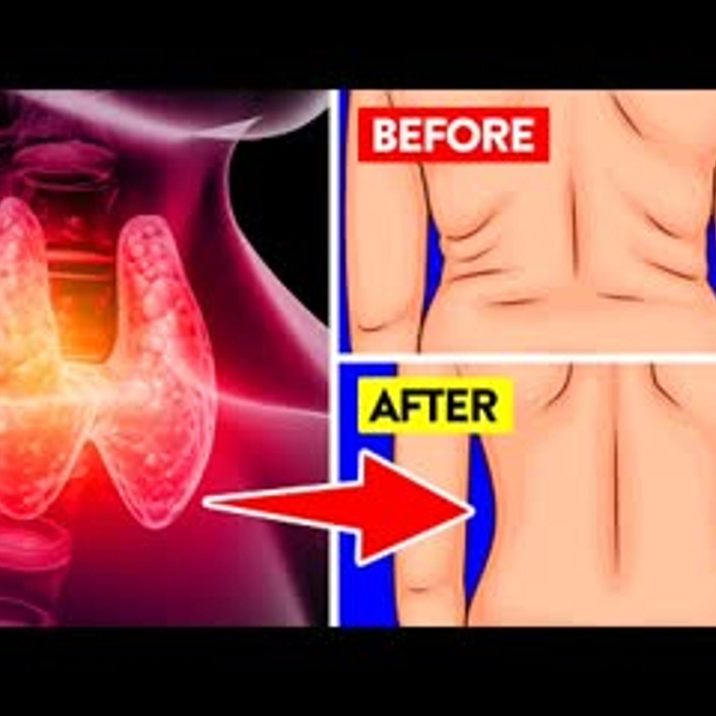 14 Unbeatable Weight Loss Tips While Having Hypothyroidism episode artwork