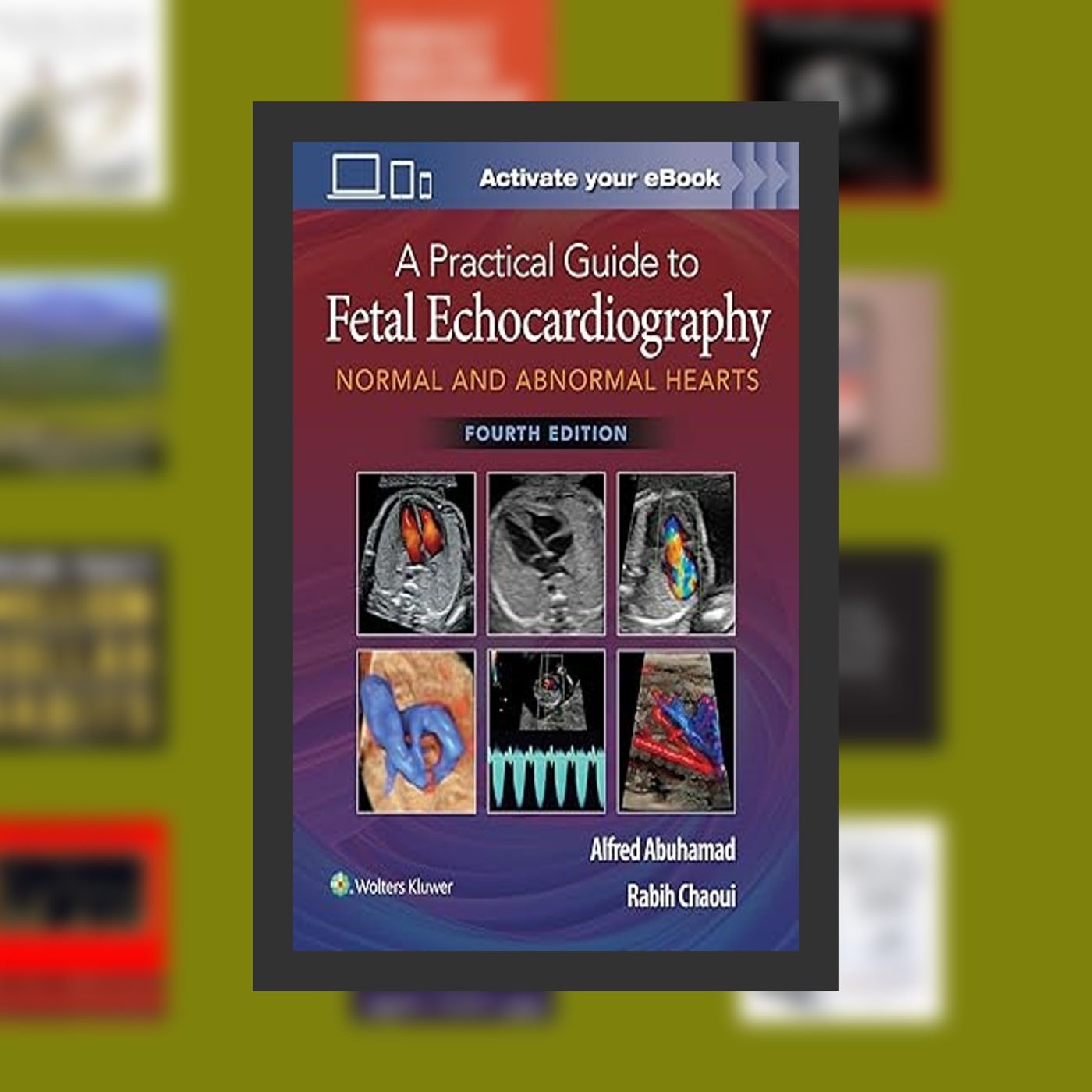 Download Pdf A Practical Guide to Fetal Echocardiography: Normal and Abnormal Hearts By  Alfred Z. Abuhamad MD (Author),  Full Epi episode artwork