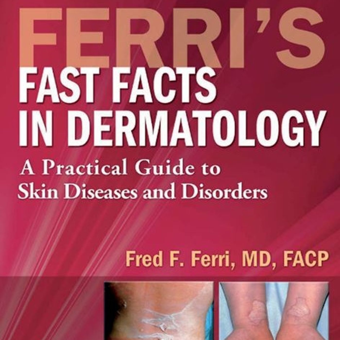 Ferri’s Fast Facts in Dermatology: A Practical Guide to Skin Diseases and Disorders