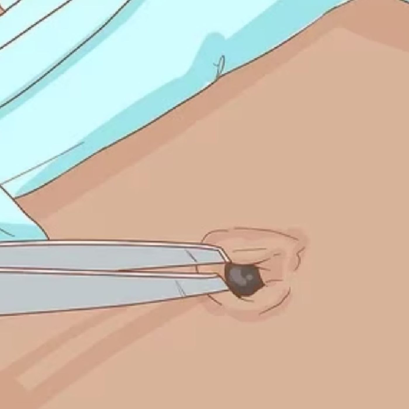 22. Not the Belly Button! Aaaaargh!