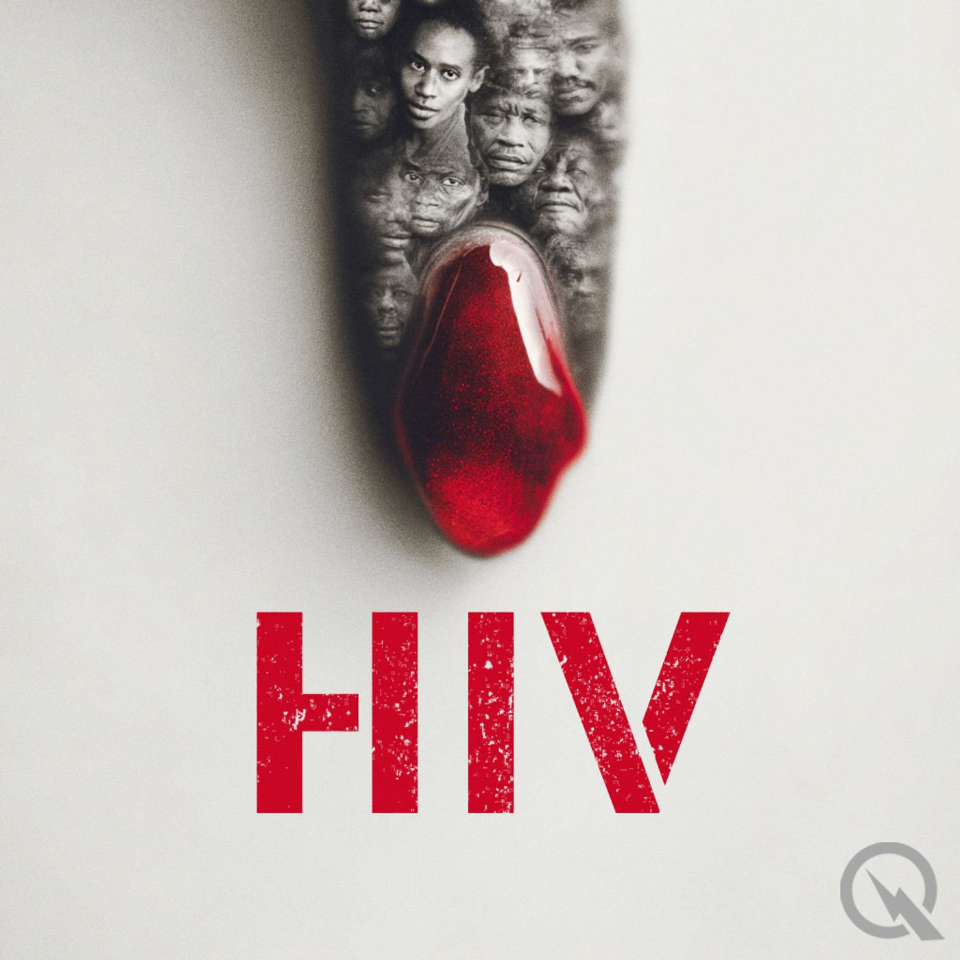 HIV