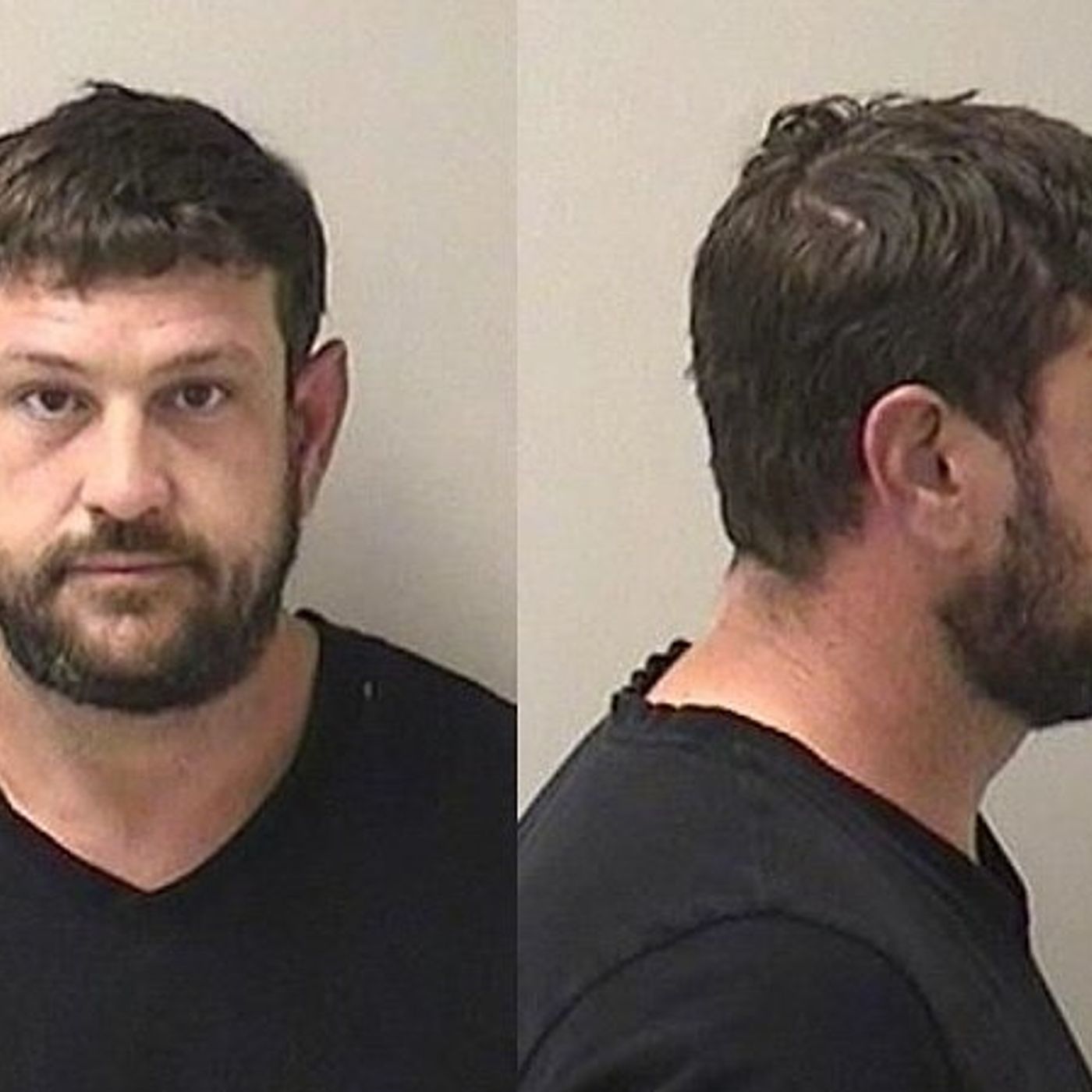 Kane County man on probation for stomping on woman’s face charged with new domestic violence felonies episode artwork