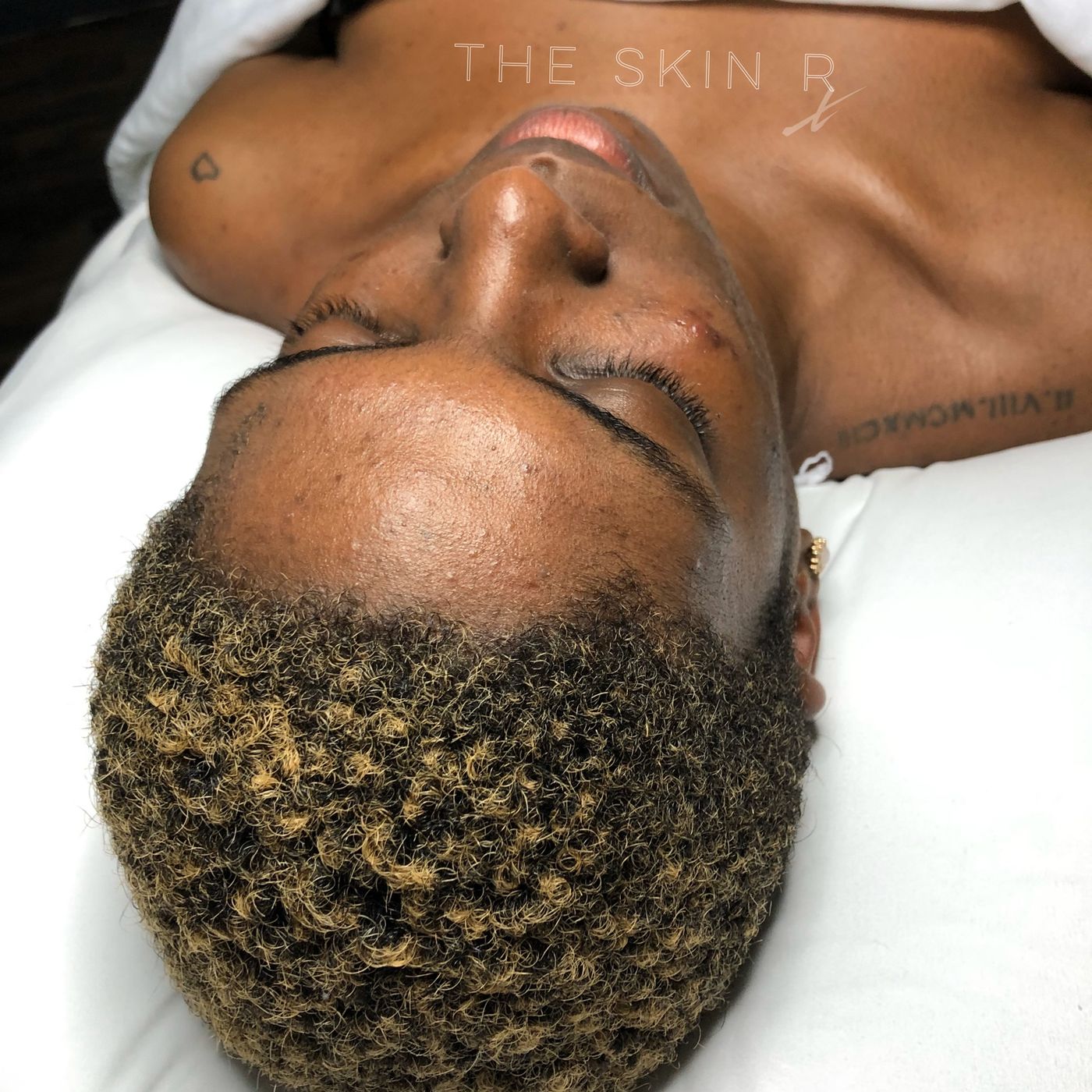 The Skin Rx