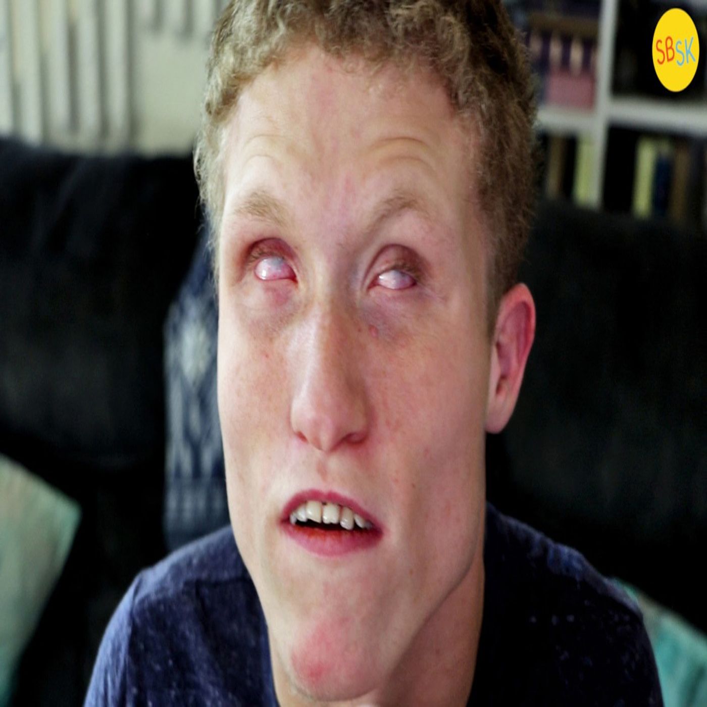 Living with a Mysterious Syndrome (Caused by Environmental Factors) Living with a Mysterious Syndrome (Caused by Environmental Factors)