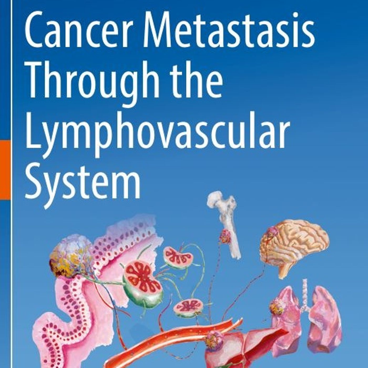 Cancer Metastasis Through the Lymphovascular System
