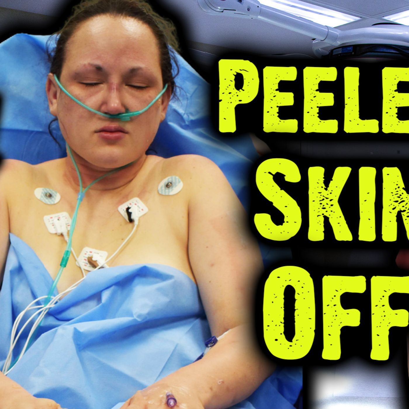 Suspect Peeled ''Lovers'' Skin Off With A Cigarette episode artwork