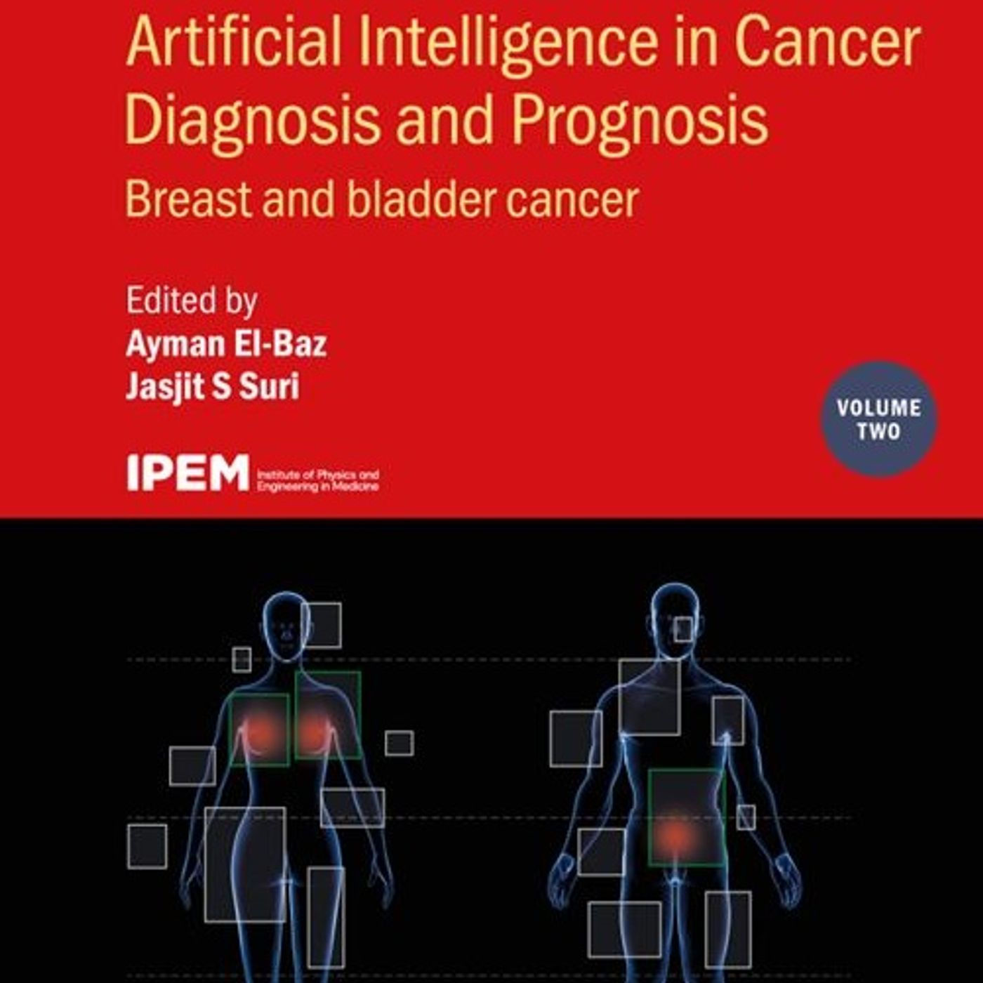 Artificial Intelligence in Cancer Diagnosis and Prognosis: Breast and bladder cancer