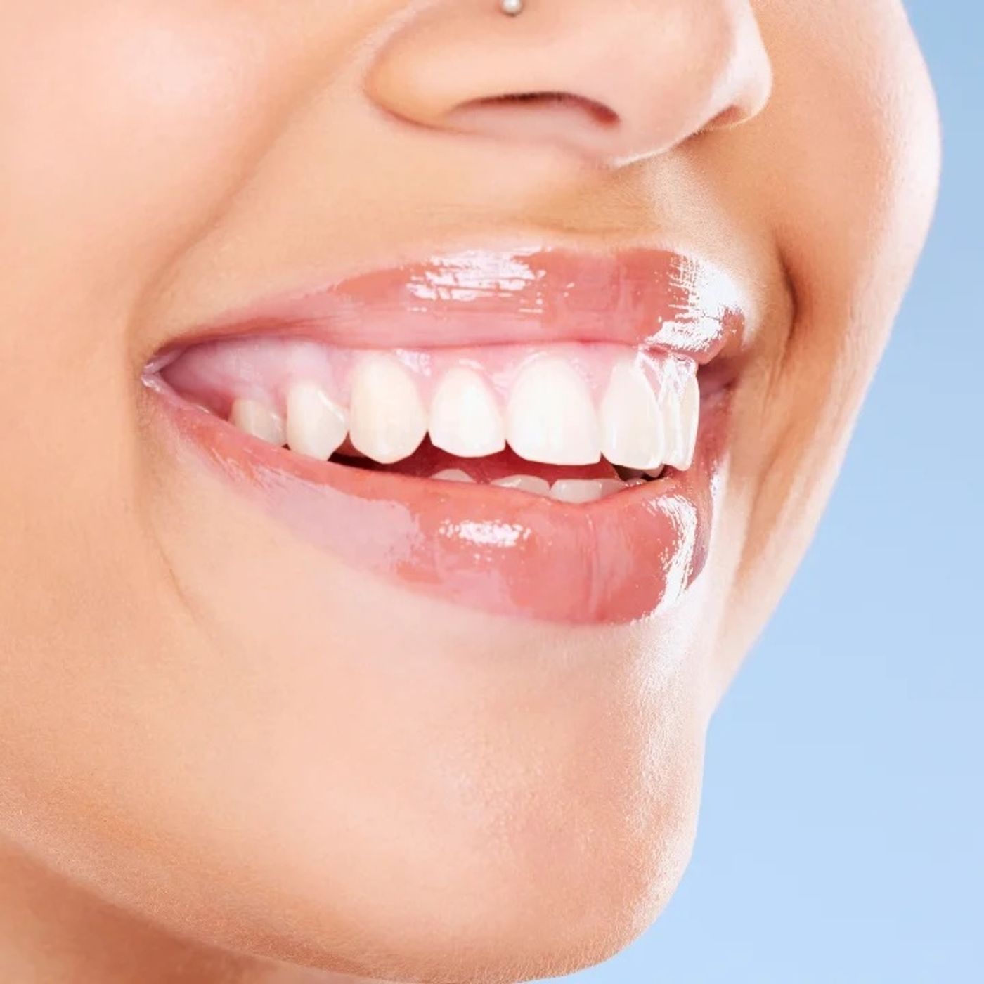 Teeth Whitening Dentist Cost in India Everything You Need to Know episode artwork