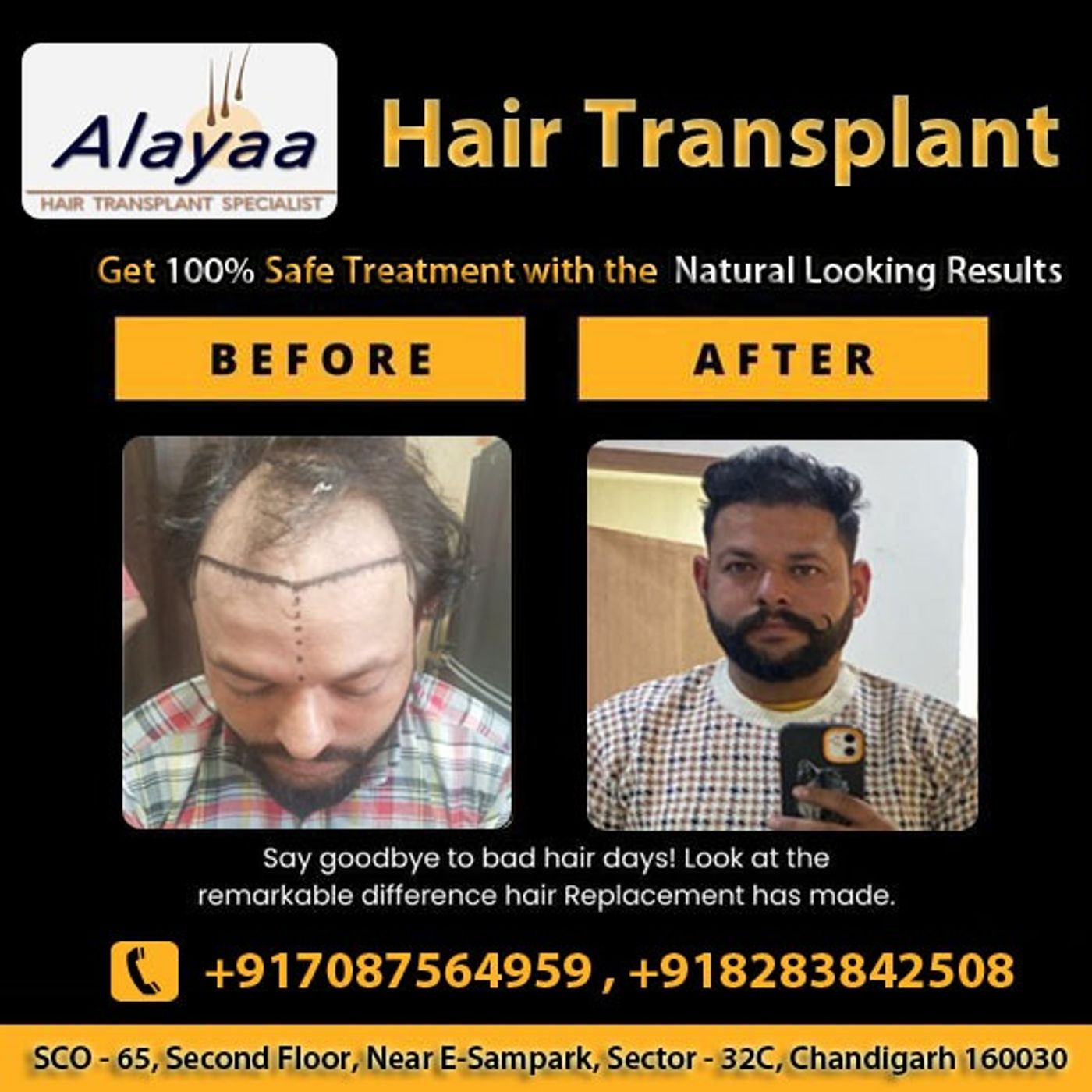Hair Transplantation and Restoration Hai podcast artwork
