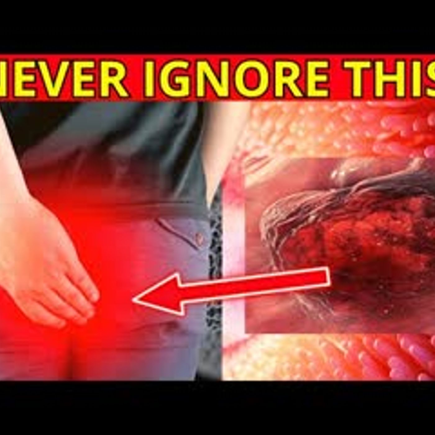 Critical Colon Cancer Symptoms You Should Never Ignore (Many People Ignore)