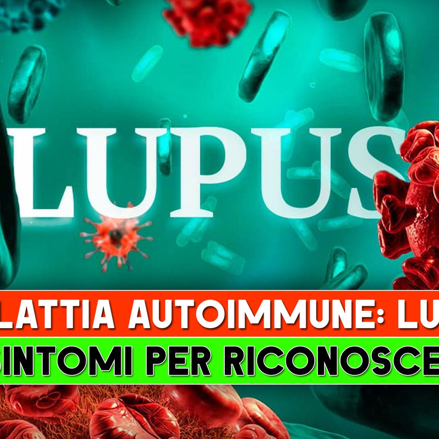 Malattia Autoimmune, Lupus: I 7 Sintomi Per Riconoscerla! episode artwork