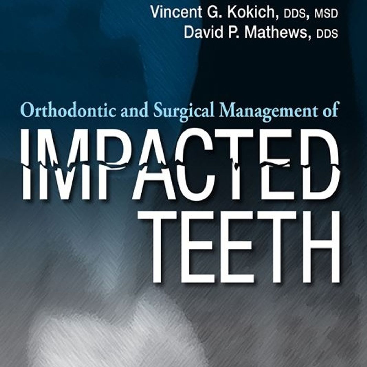 Orthodontic and Surgical Management of Impacted Teeth