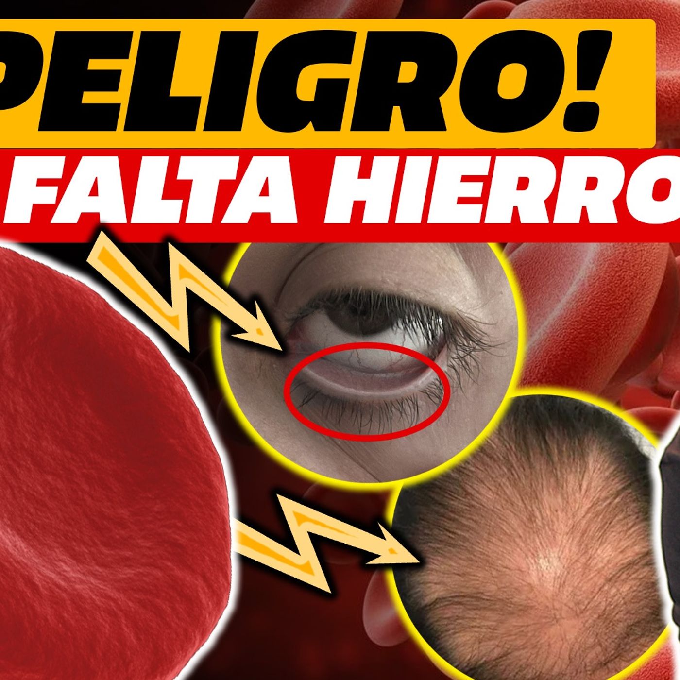 ¡CUIDADO! HIERRO BAJO⚠️Primeros SÍNTOMAS, ELEMENTOS que INHIBEN su ABSORCIÓN y ALIMENTOS a tomar