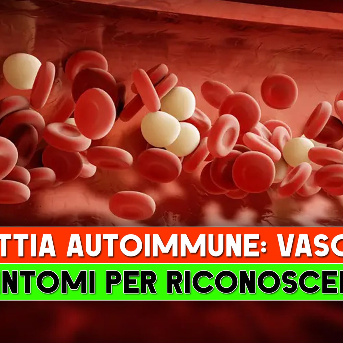 Malattia Autoimmune, Vasculite: I 7 Sintomi Per Riconoscerla! episode artwork