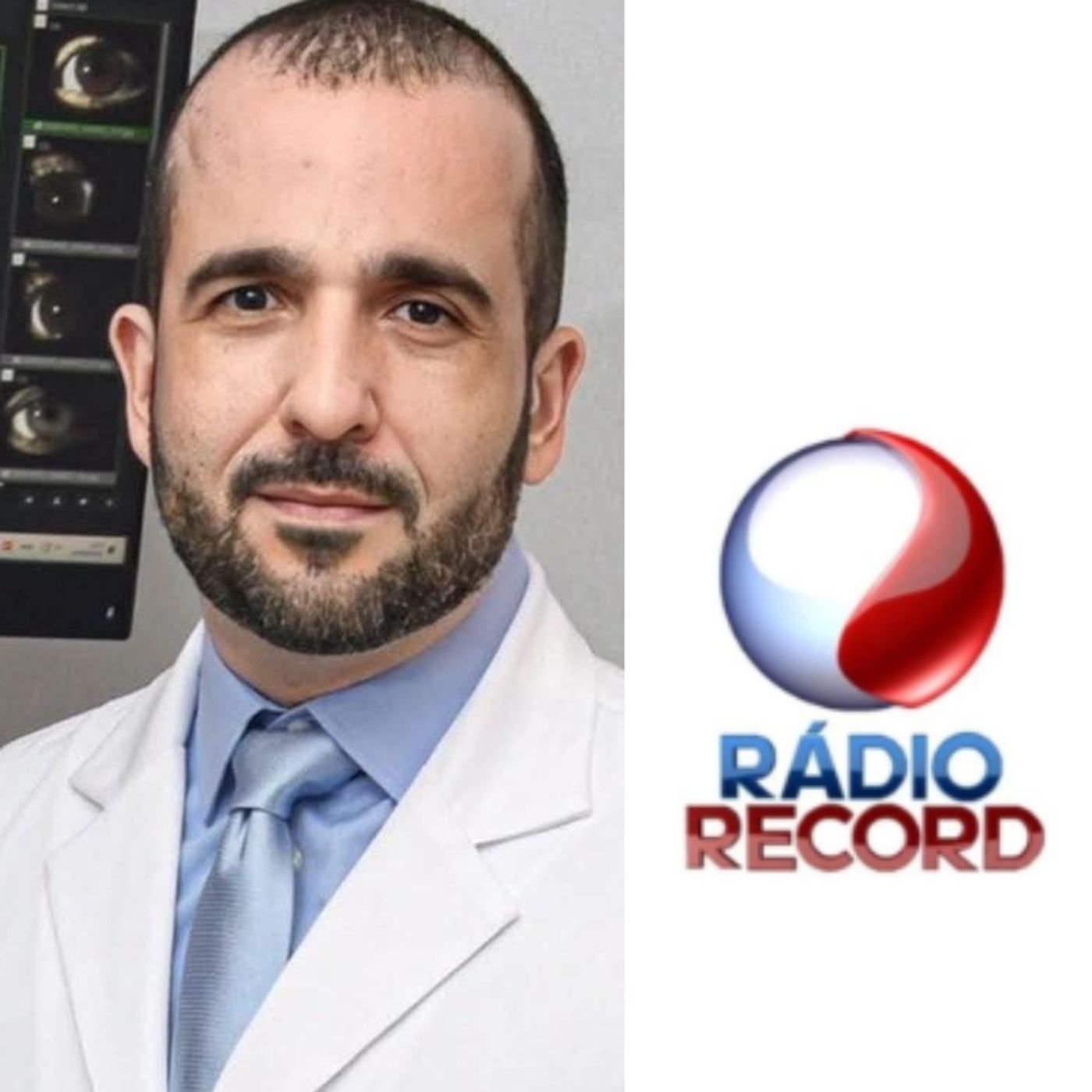 RÁDIO RECORD: DÚVIDAS SOBRE O GLAUCOMA episode artwork