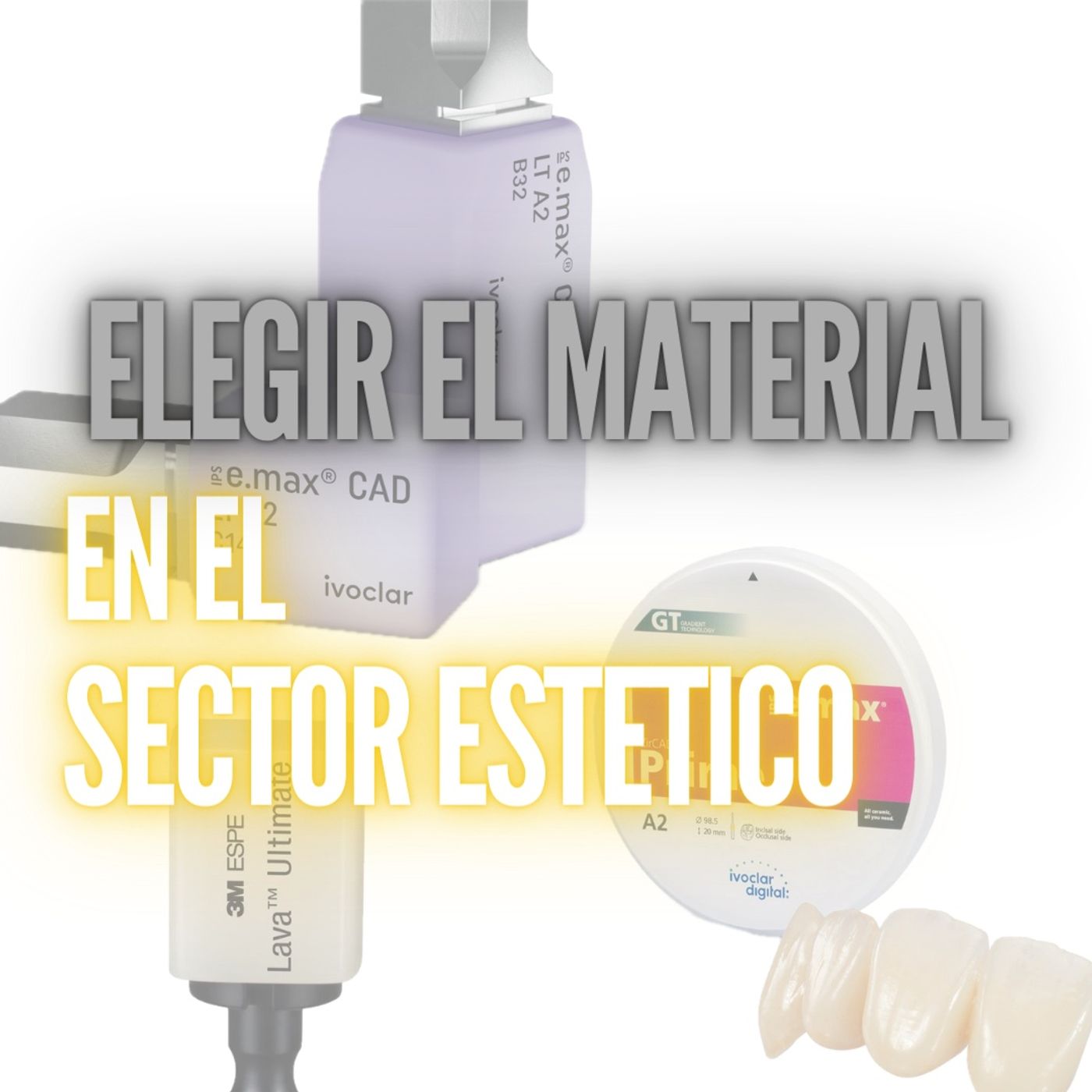 Ep. 13 ¿Que material restaurador usar en anteriores?