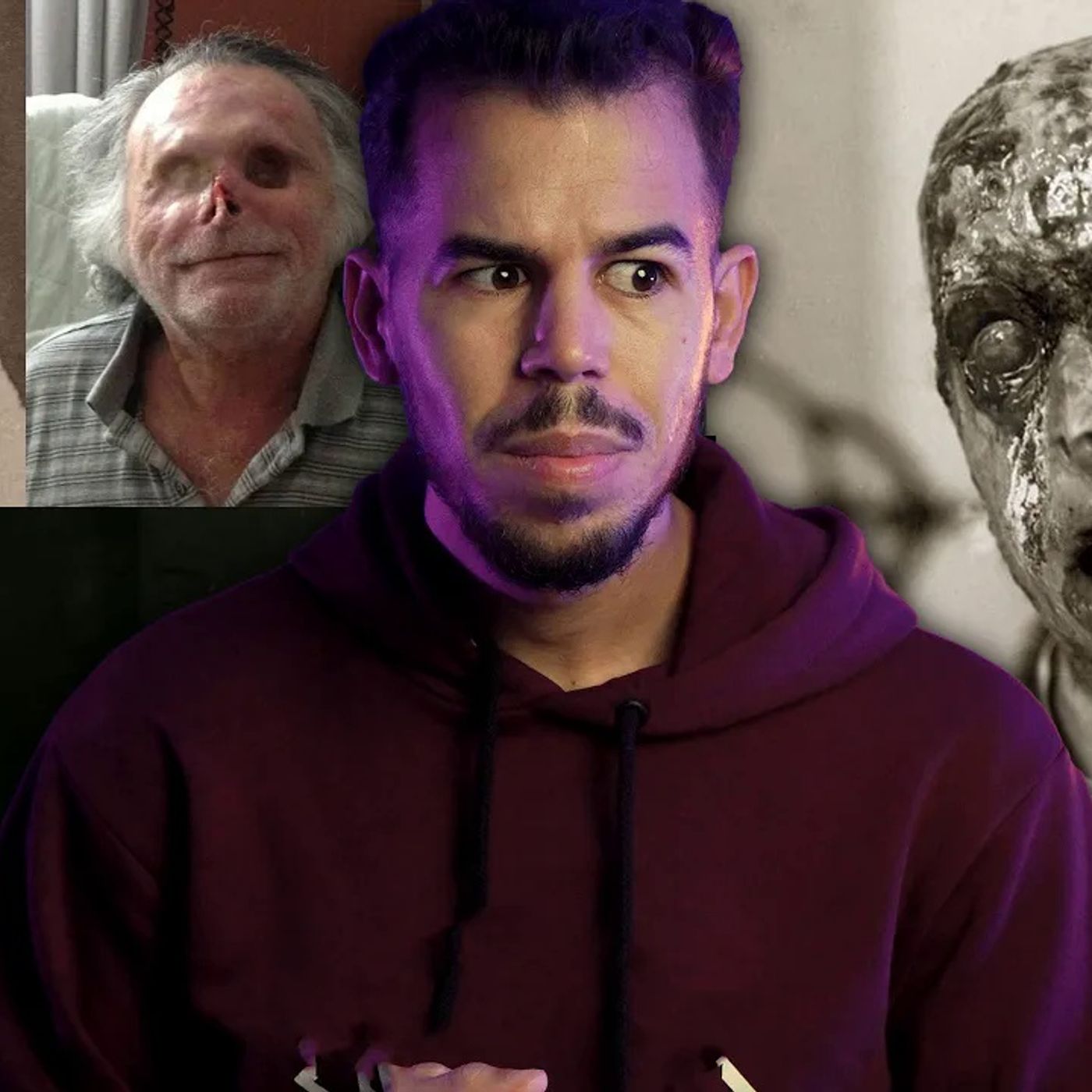 الجذام - أبــشــع مرض عرفه الإنسان الجذام - أبــشــع مرض عرفه الإنسان