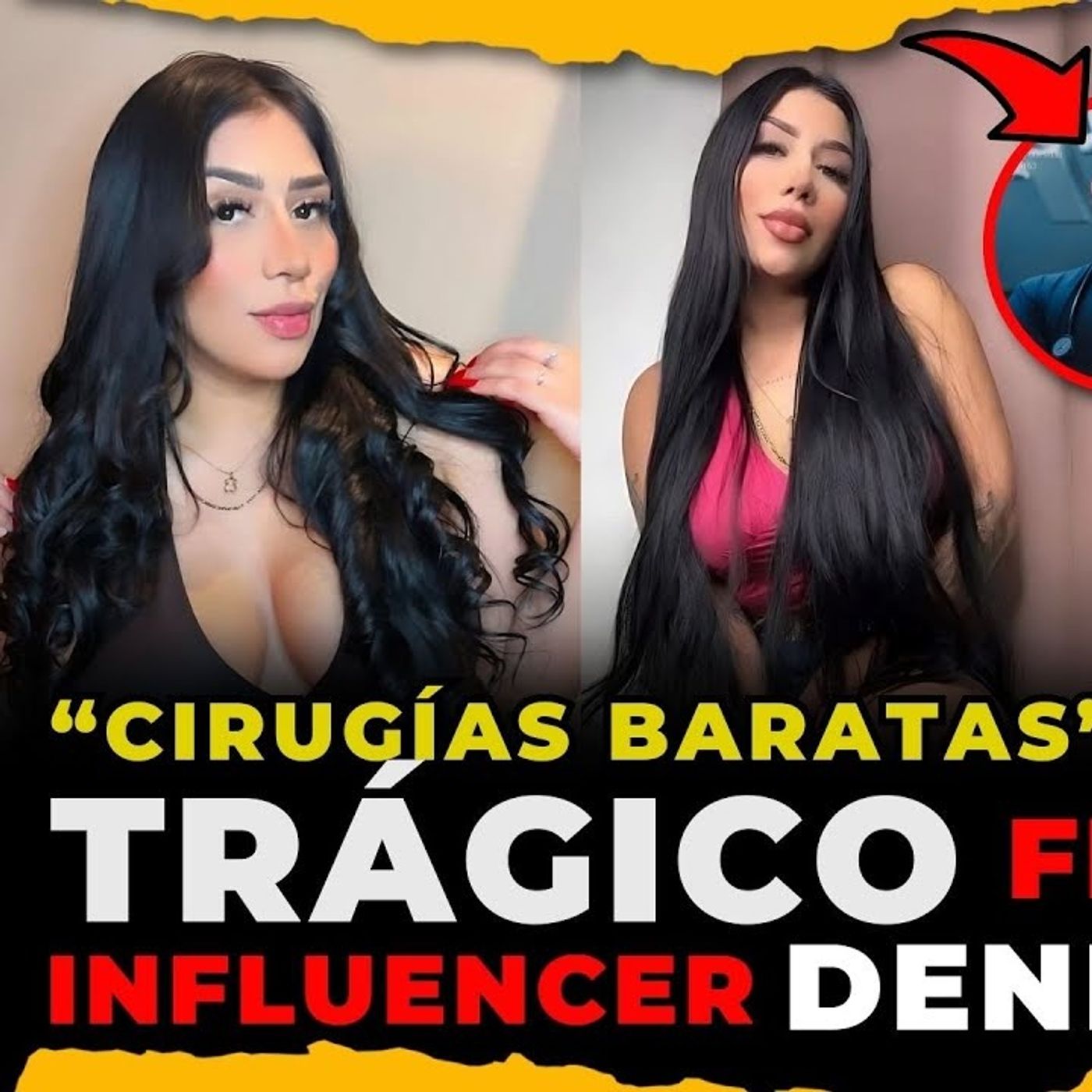 EL CASO DE DENISSE REYES LA INFLUENCER QUE MUERE TRAS CIRUGÍA ESTÉTICA episode artwork