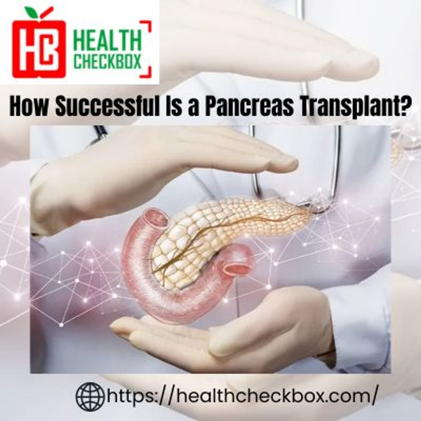 How Successful Is a Pancreas Transplant?