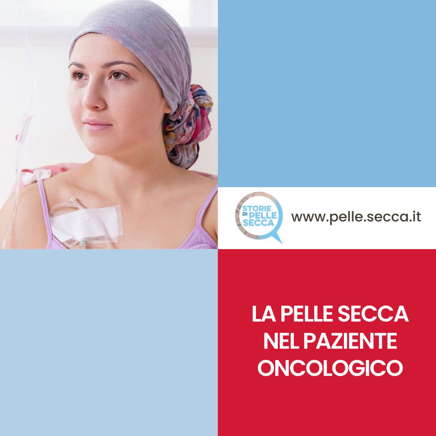 Storie di Pelle Secca