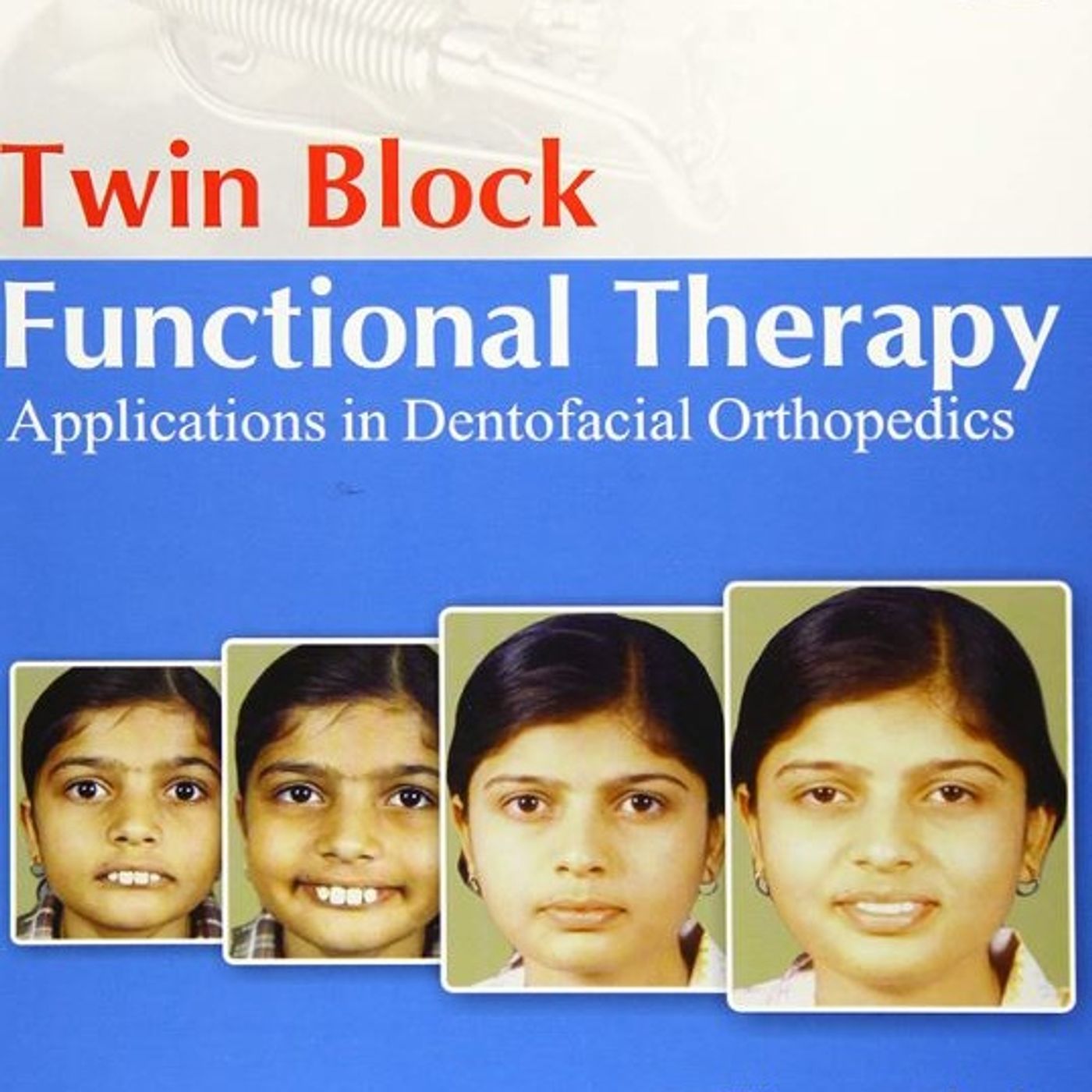 Twin Block Functional Therapy: Applications in Dentofacial Orthopedics