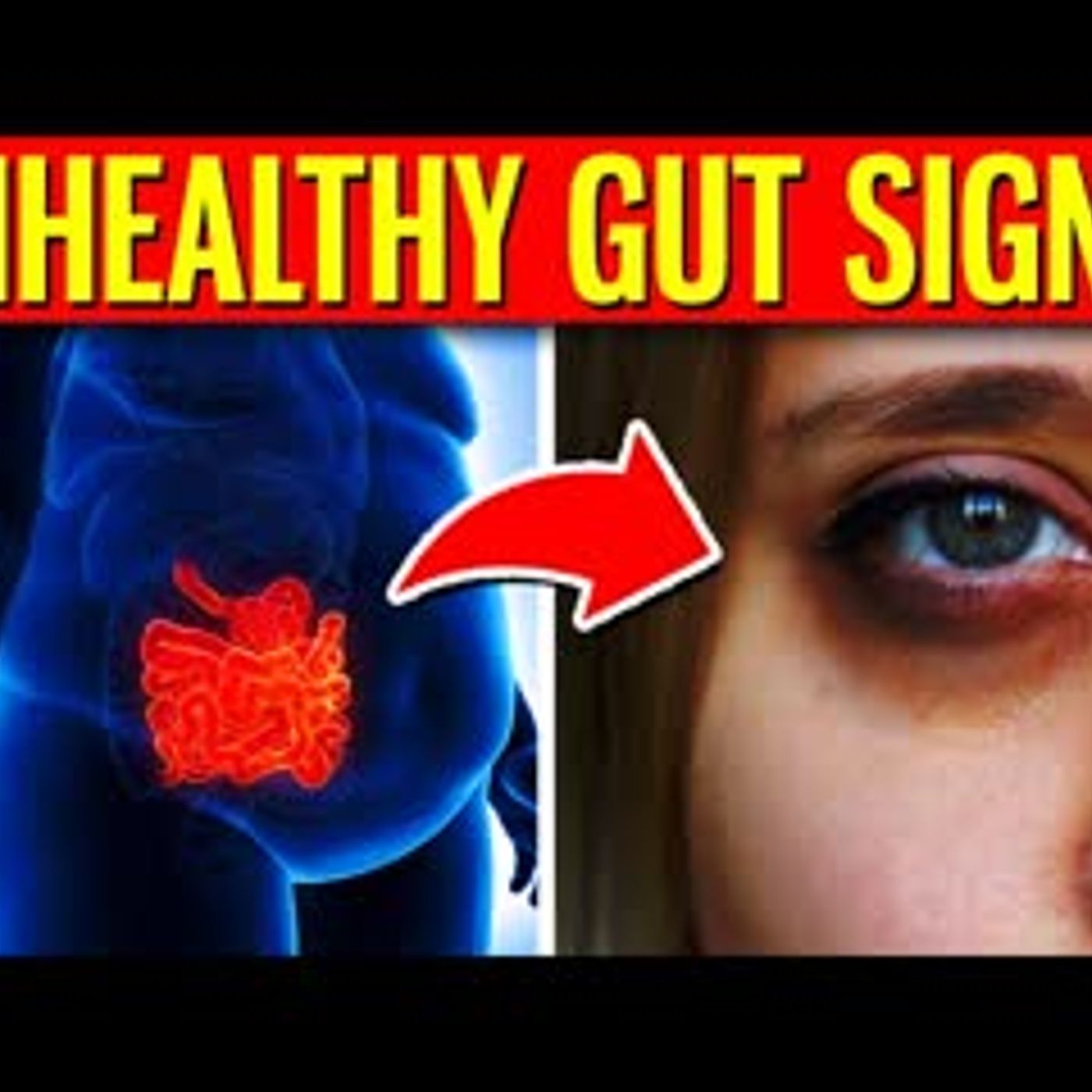 10 Warning Signs You Have An UNHEALTHY Gut episode artwork