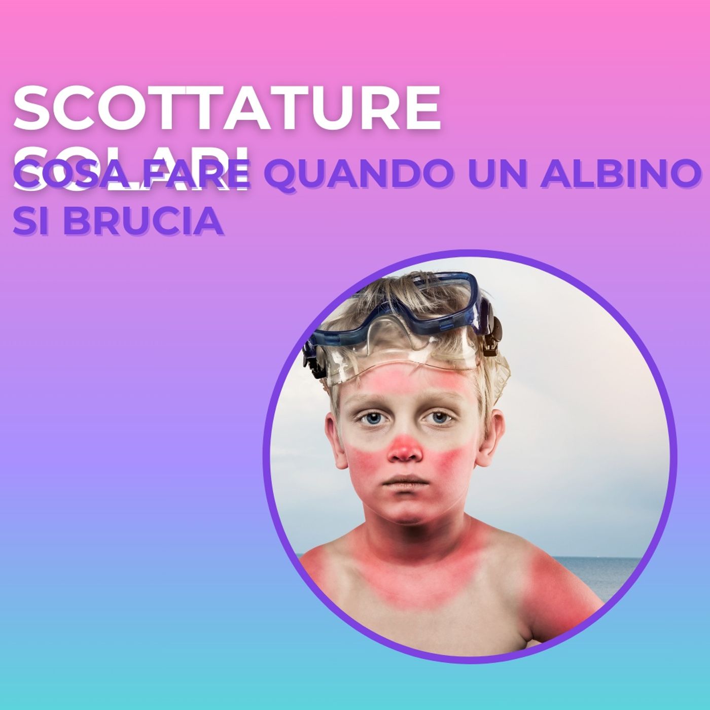 Nero su bianco  - storie di albinismo