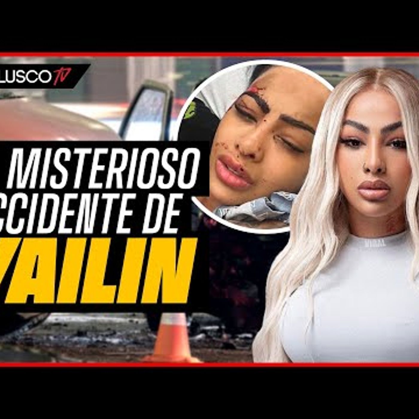 014. Yailín herida por “accidente” DESTAPAMOS LA VERDAD “¿Donde están los golpes de 6ix9ine”