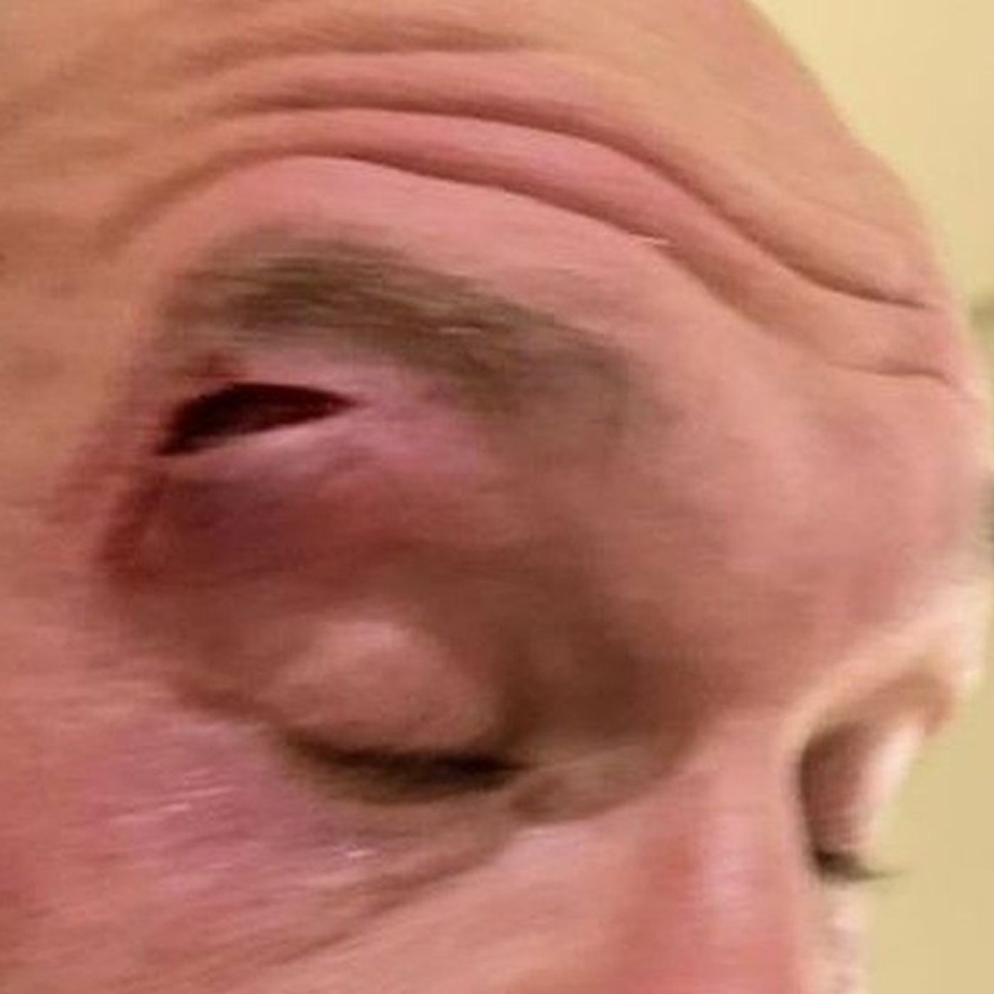 Fury vs Usyk is off! Fury Suffers a Cut in Sparring episode artwork
