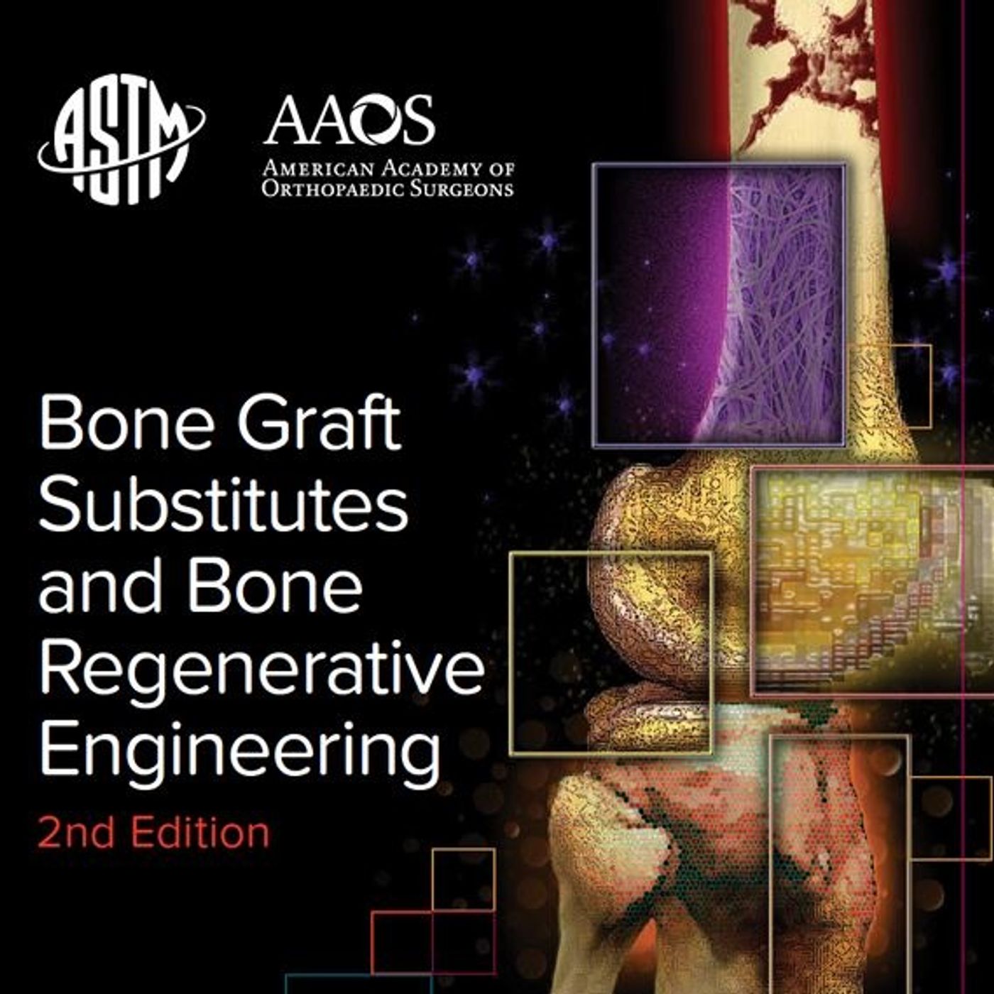Bone Graft Substitutes and Bone Regenerative Engineering