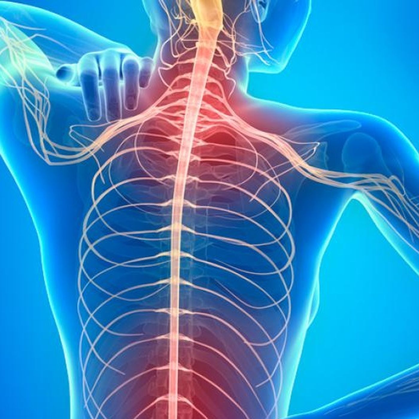 Comprendiendo la ESCLEROSIS MÚLTIPLE