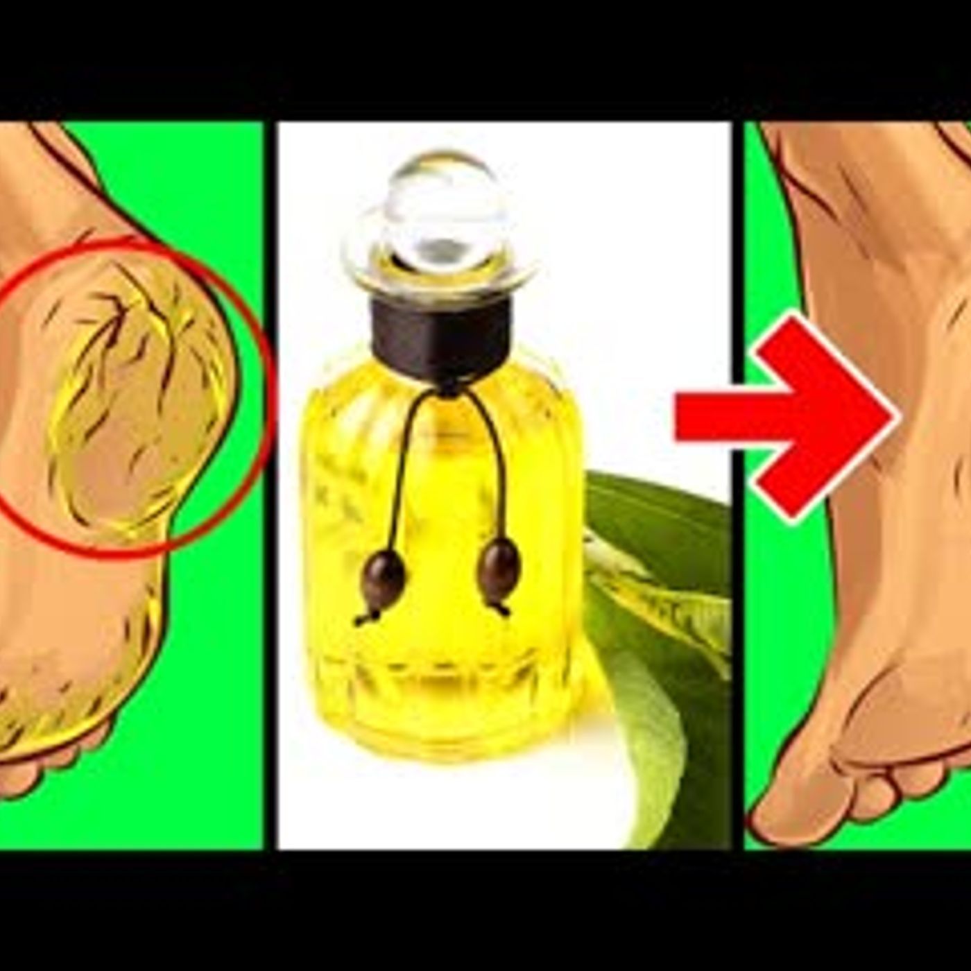 14 Camphor Oil Health Benefits You Never Knew Of episode artwork