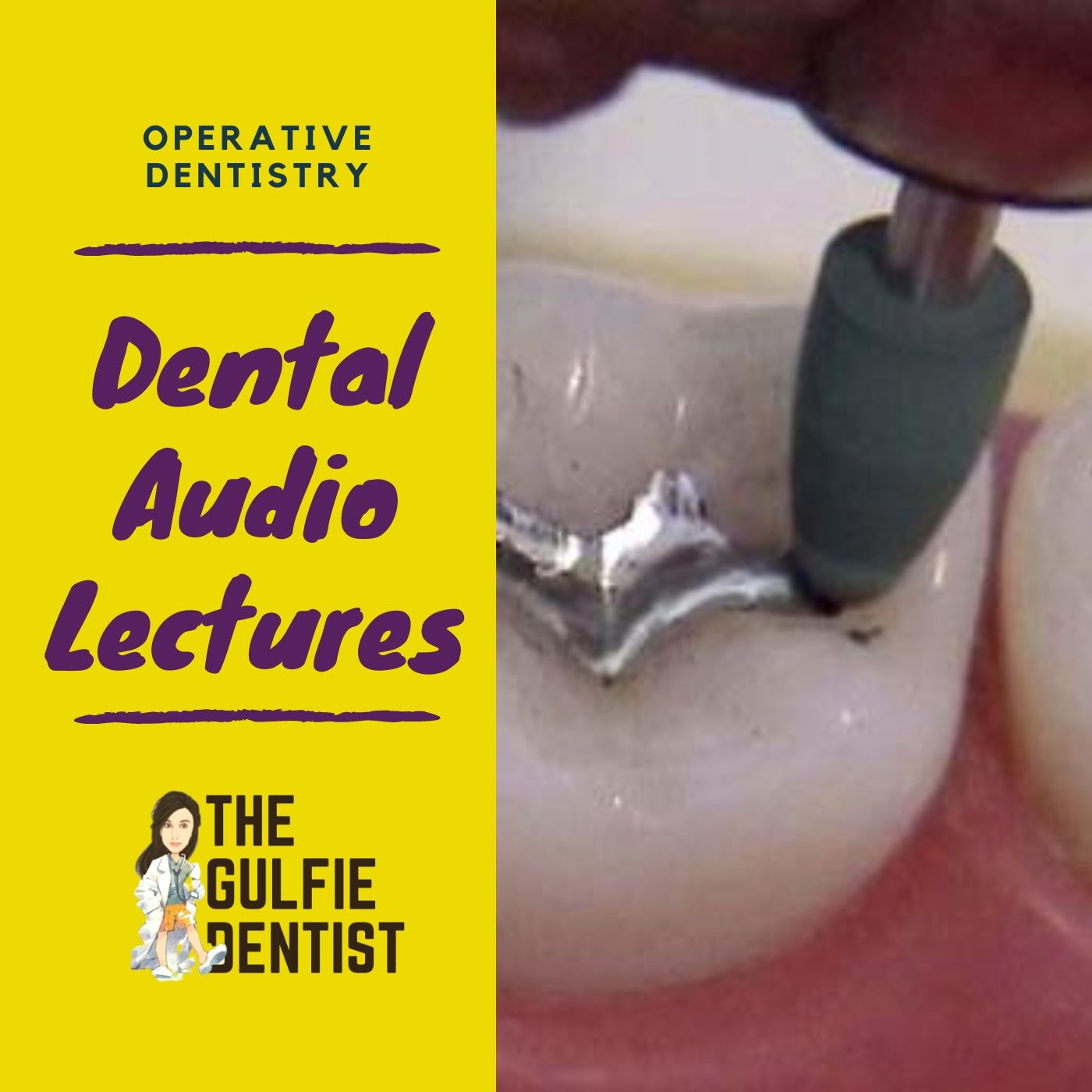 OPERATIVE DENTISTRY