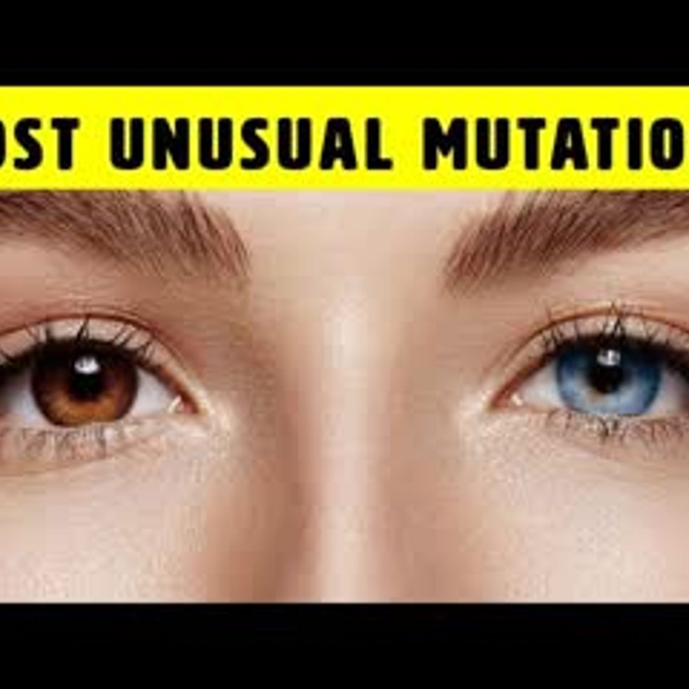 10 Unusual Genetic Mutations Of The Human Body episode artwork