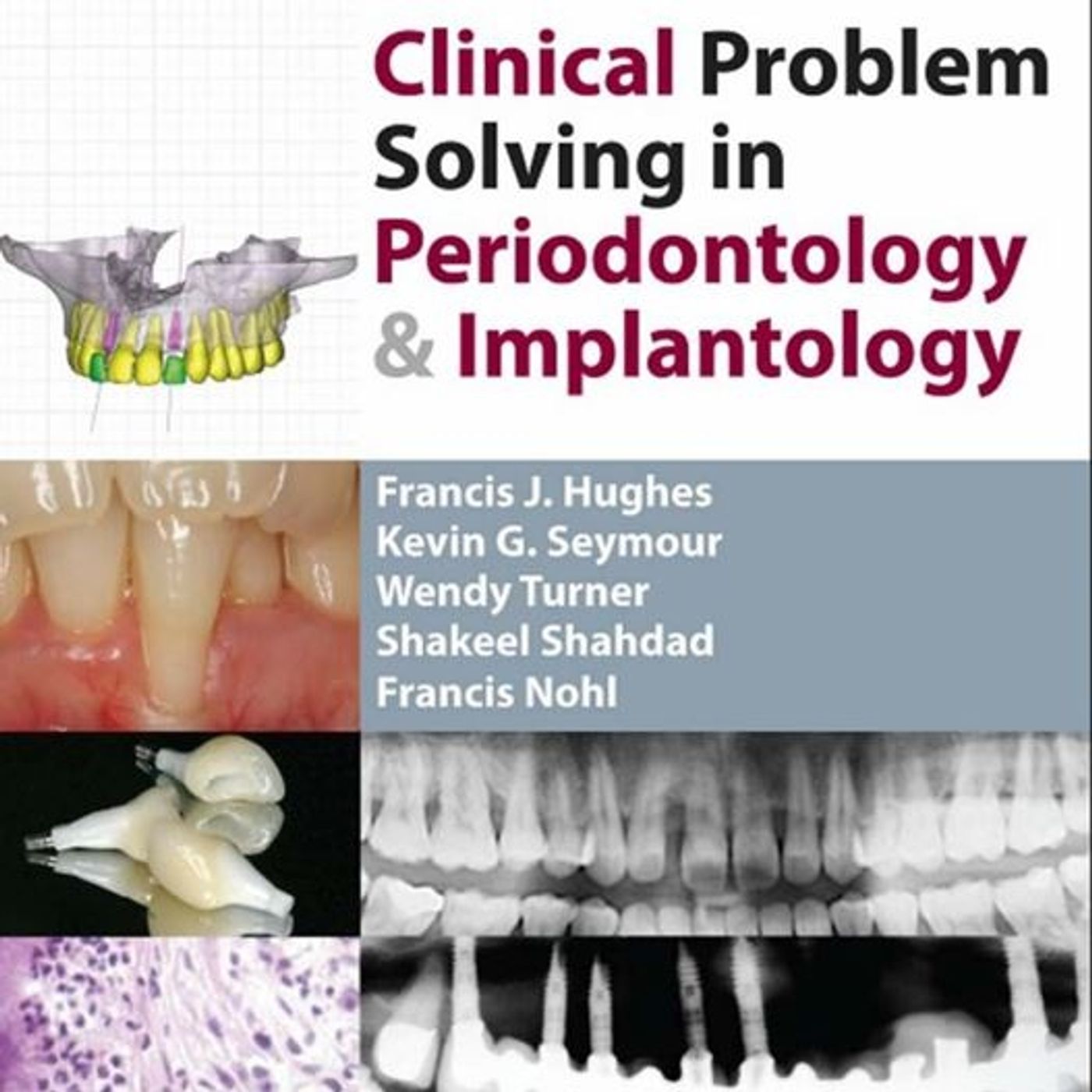 Clinical Problem Solving in Periodontology & Implantology