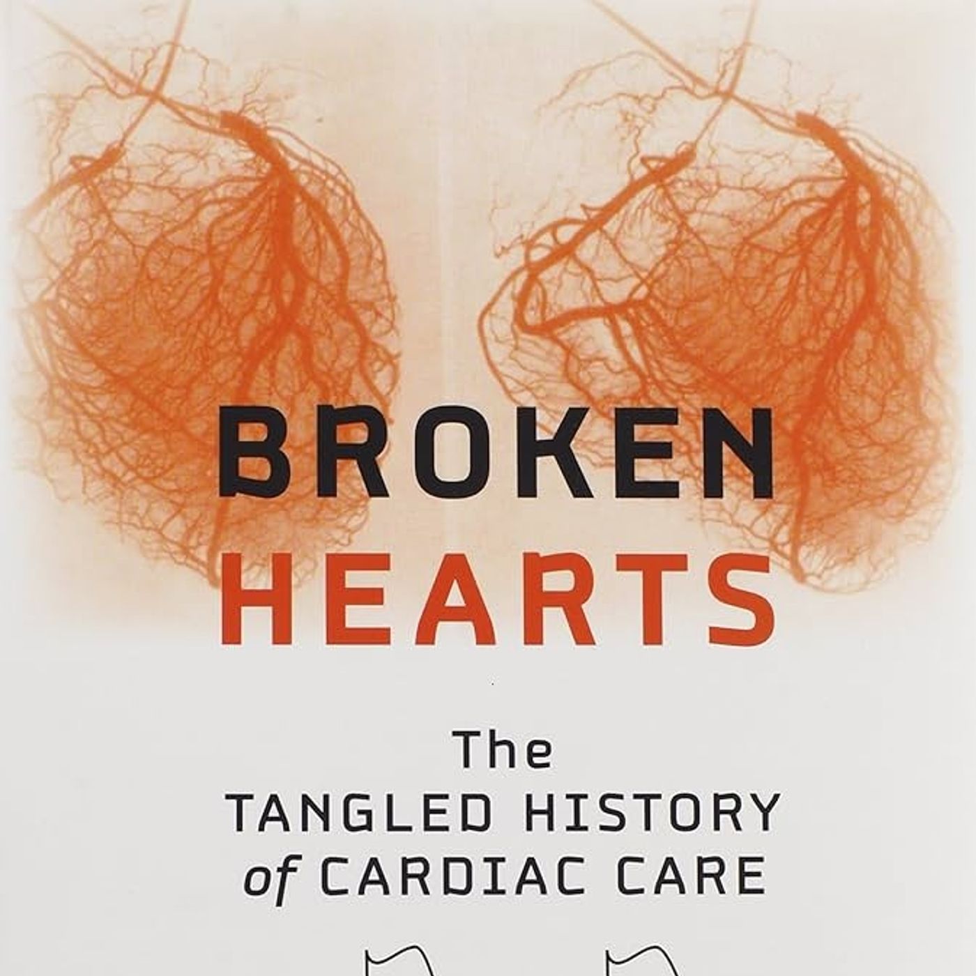 Broken Hearts: The Tangled History of Cardiac Care