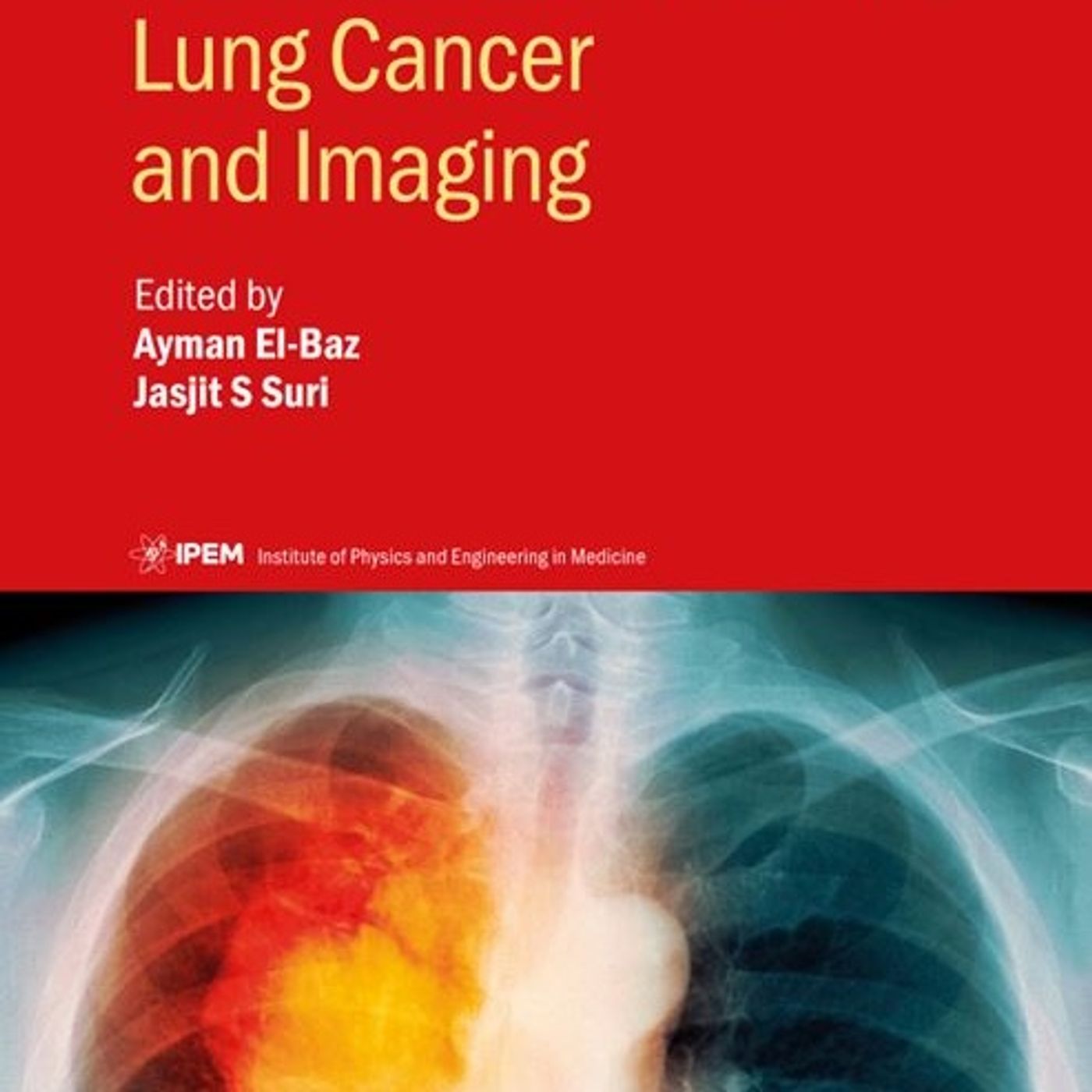 Lung Cancer and Imaging