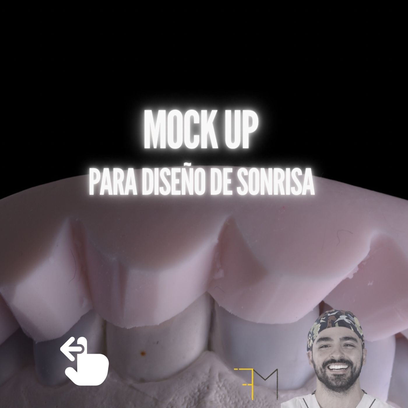 Ep.10 - MockUp para Diseño de Sonrisa, de la A a la Z episode artwork