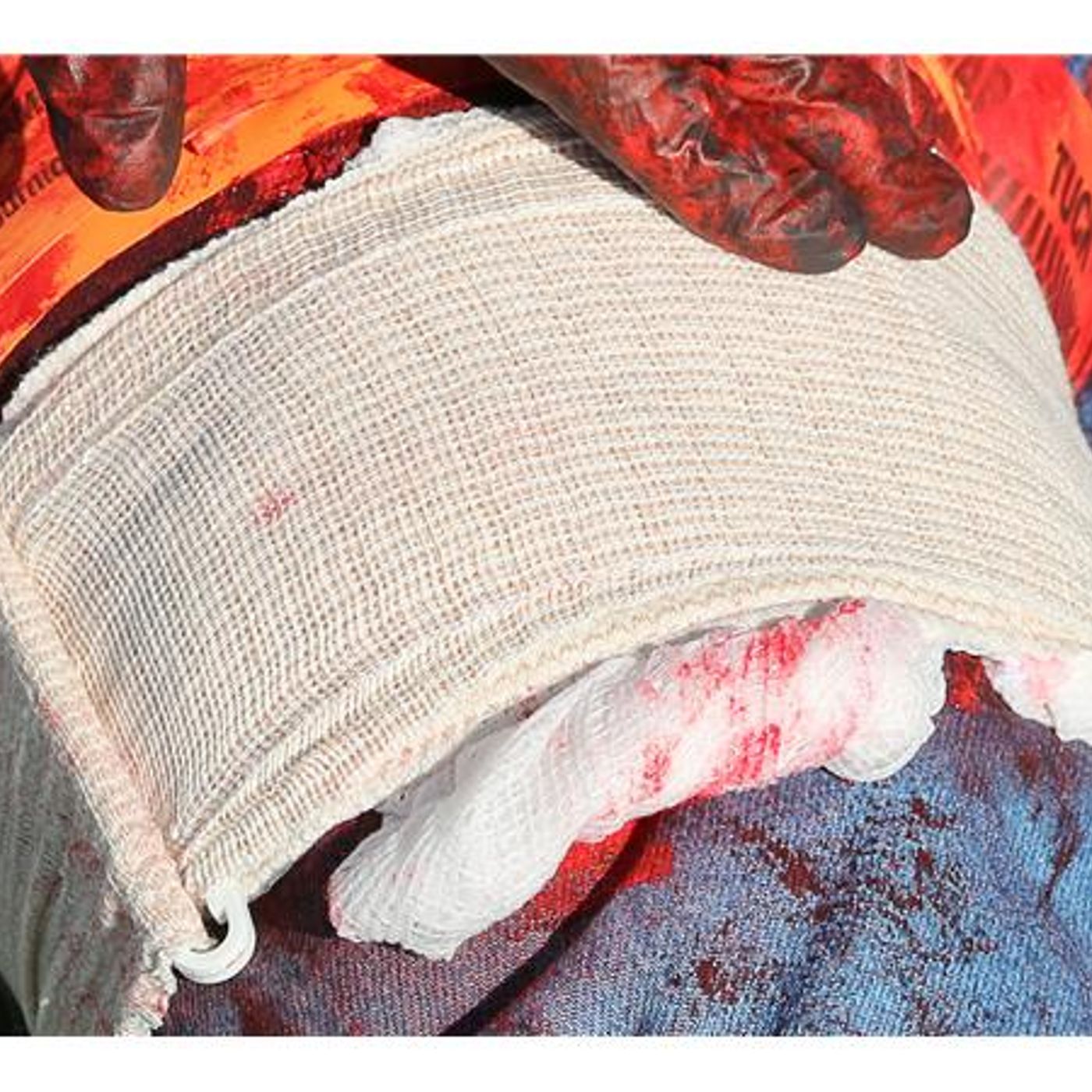 Survival Medicine Hour: Would Cleaning, Medical Backpacks, More