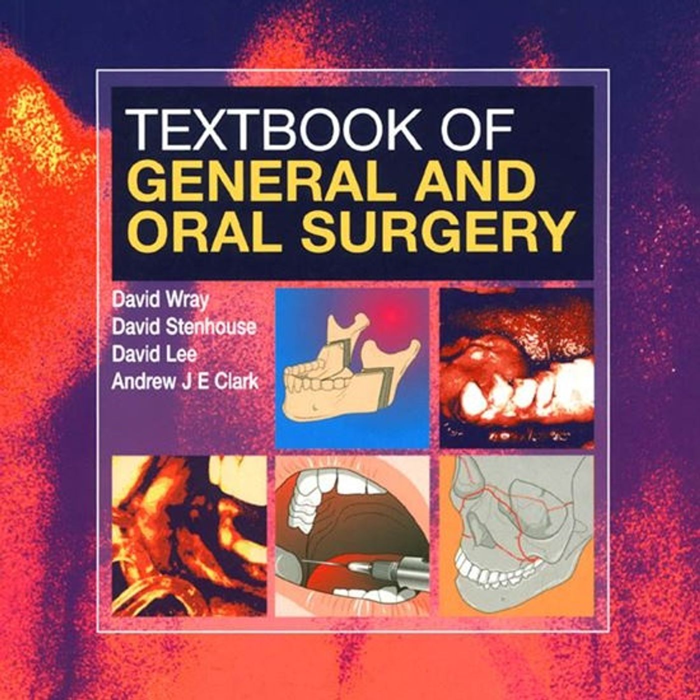 TextBoook of General and Oral Surgery