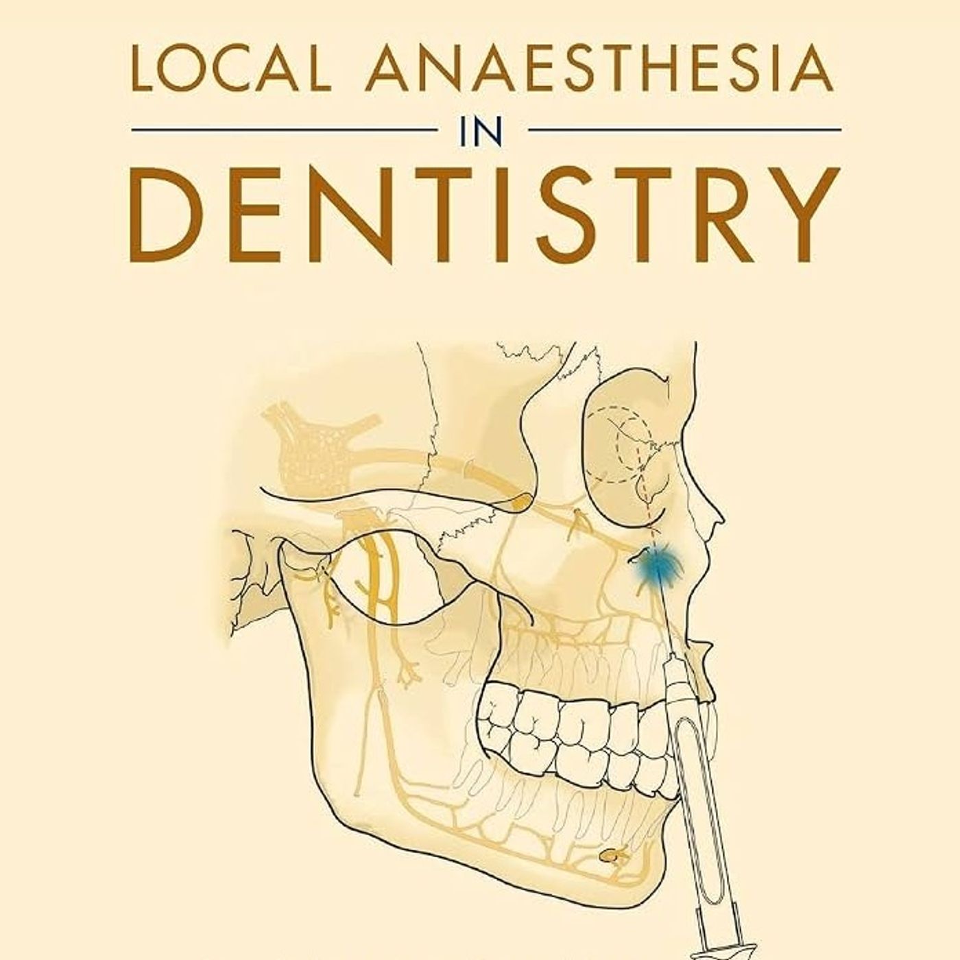 Local Anaesthesia in Dentistry