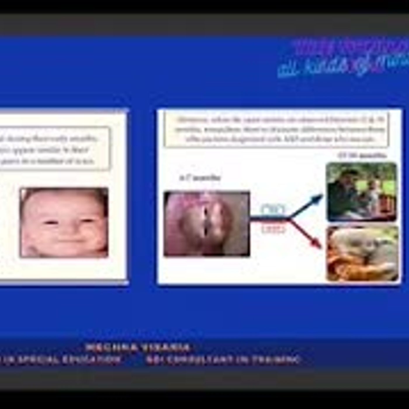 Neurodiversity Nation: Amplifying Voices