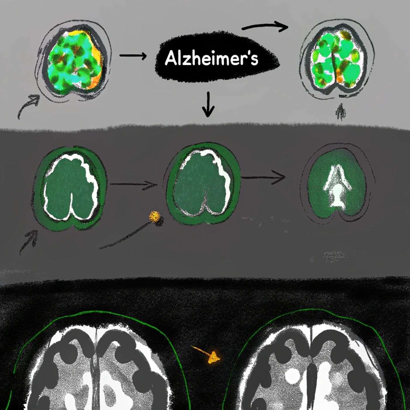 Detecting Alzheimer's 20 Years Before Symptoms: The Hidden Roadmap